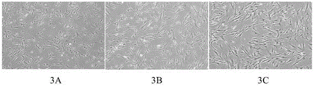 Kit for culturing hUC-MSC step by step and hUC-MSC obtained by adopting same