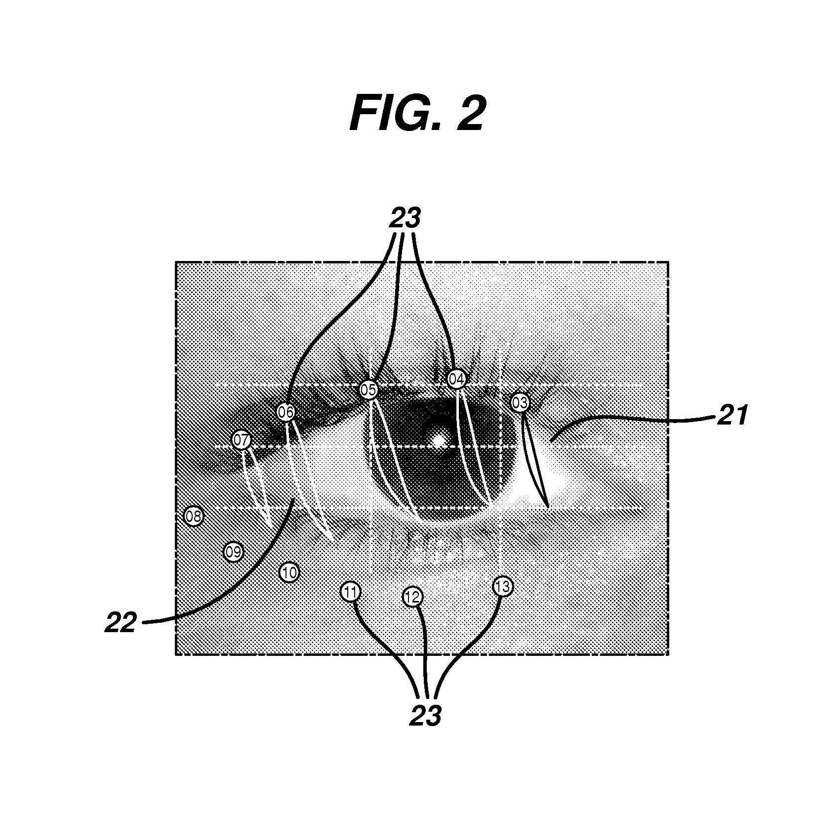 Method for evaluating eyelid movement and contact lens position