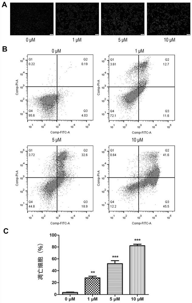 A kind of ACC inhibitor and its medicinal use