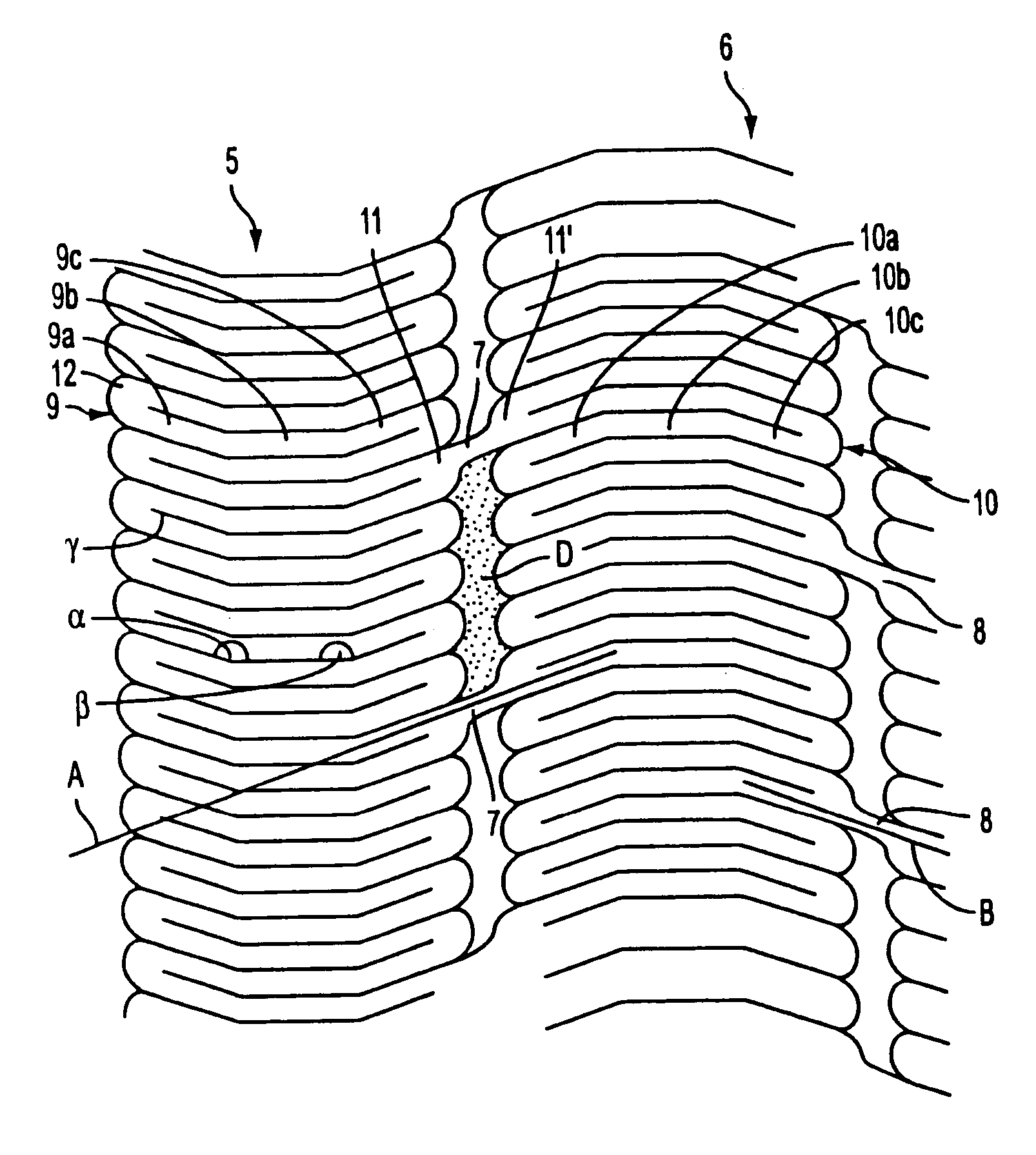 Methods and apparatus for stenting comprising enhanced embolic protections coupled with improved protections against restenosis and trombus formation
