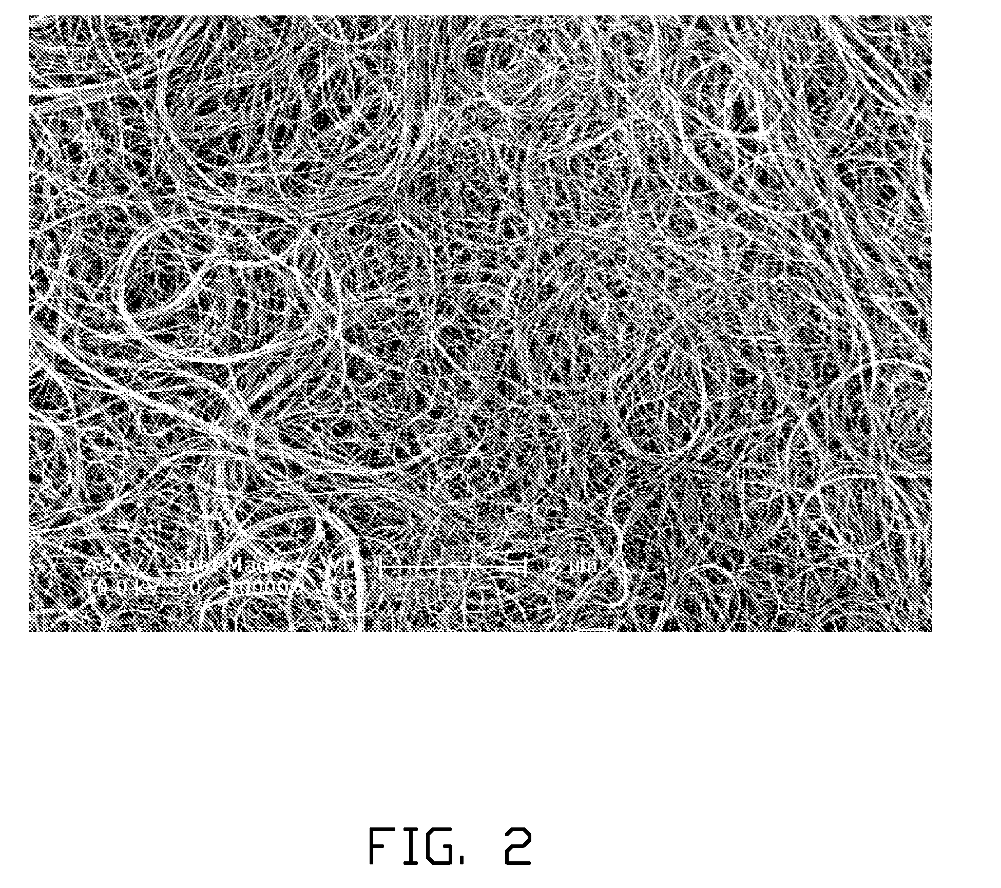 Surface-enhanced raman scattering substrate and raman detecting system having the same