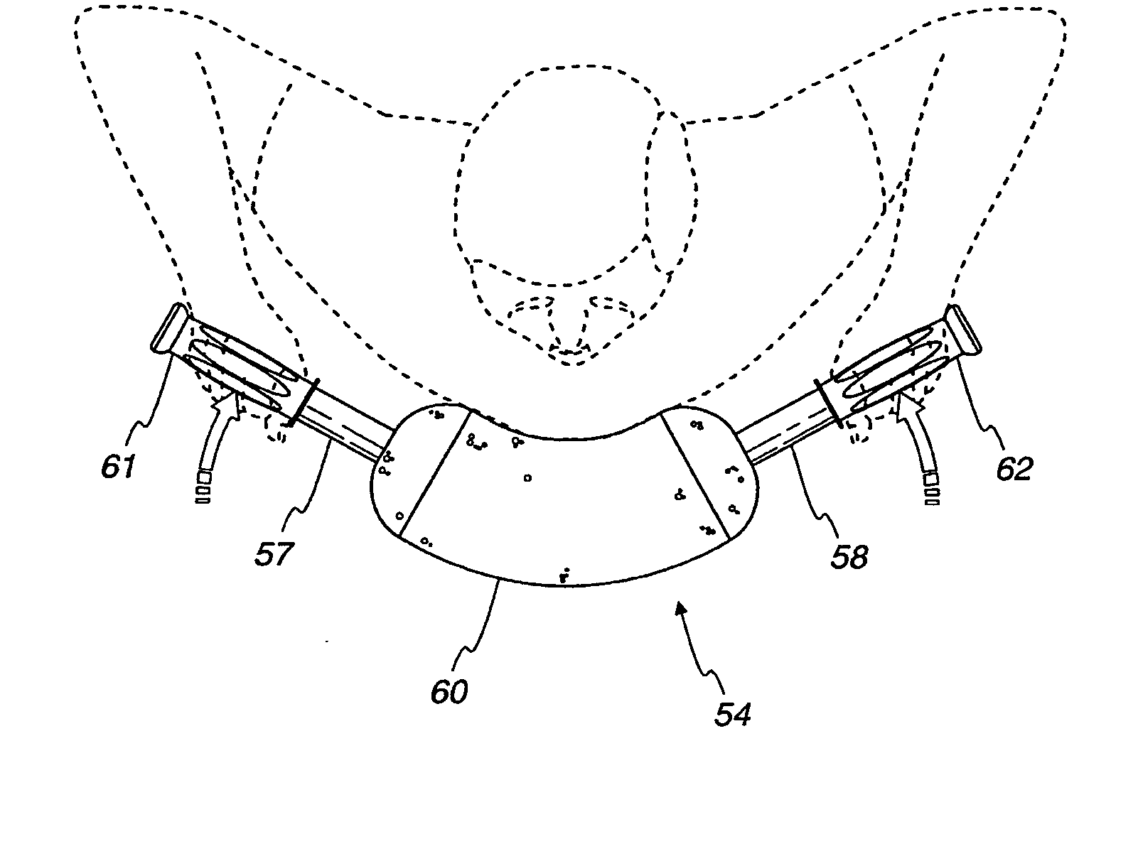 Exercise device and methods