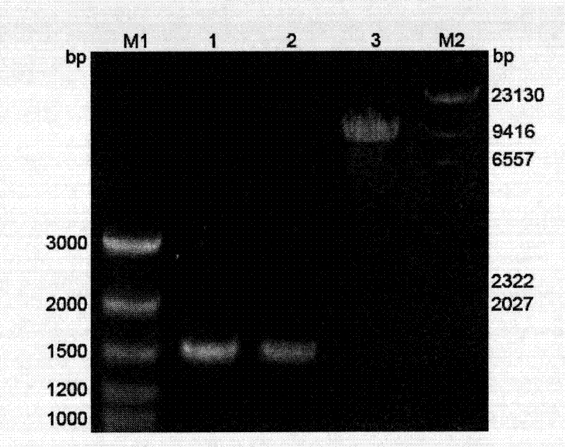 Method for designing human aldehyde dehydrogenase 2 sequence according to preferred codon of pichia pastoris