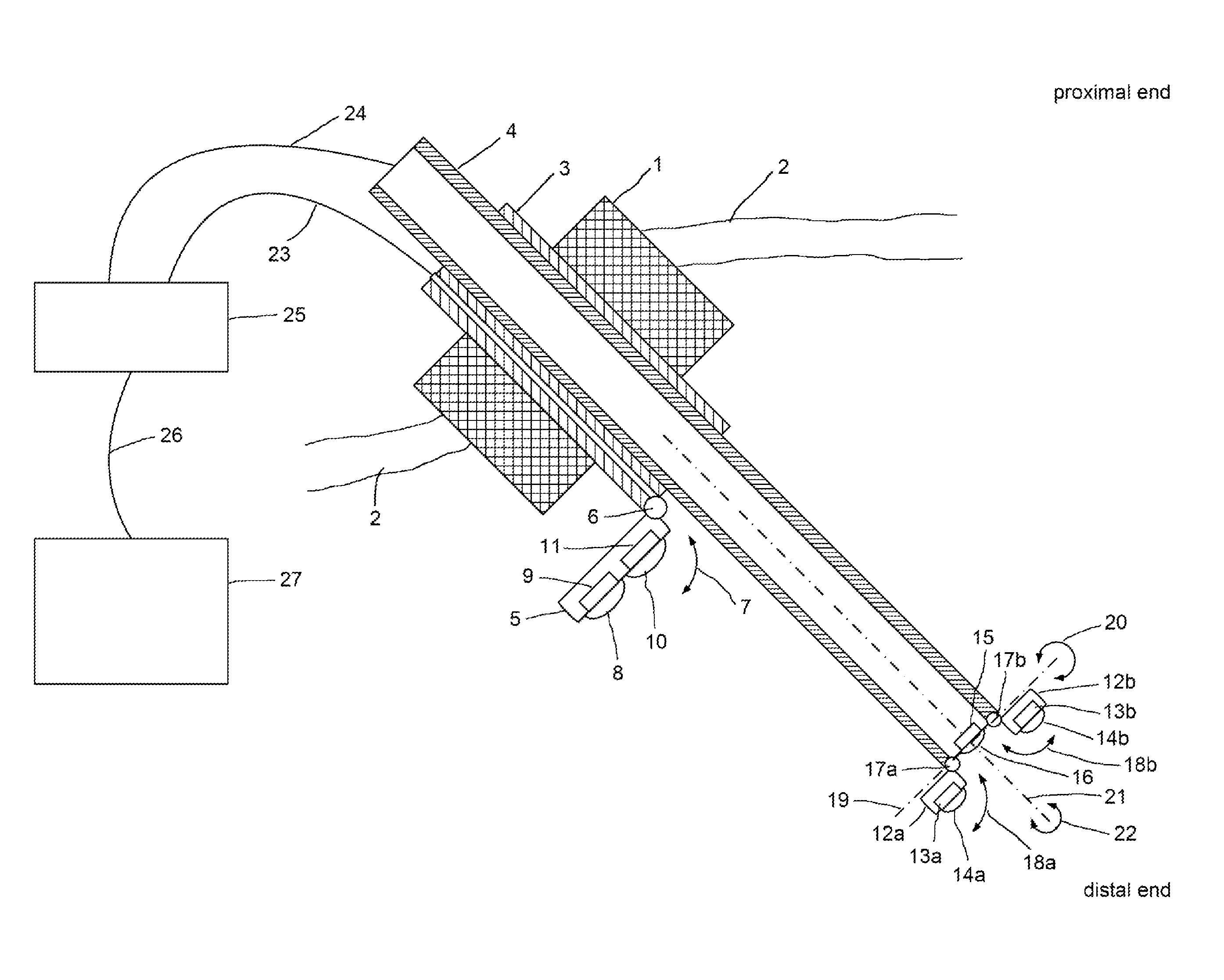 Endoscope comprising a system with multiple cameras for use in minimal-invasive surgery