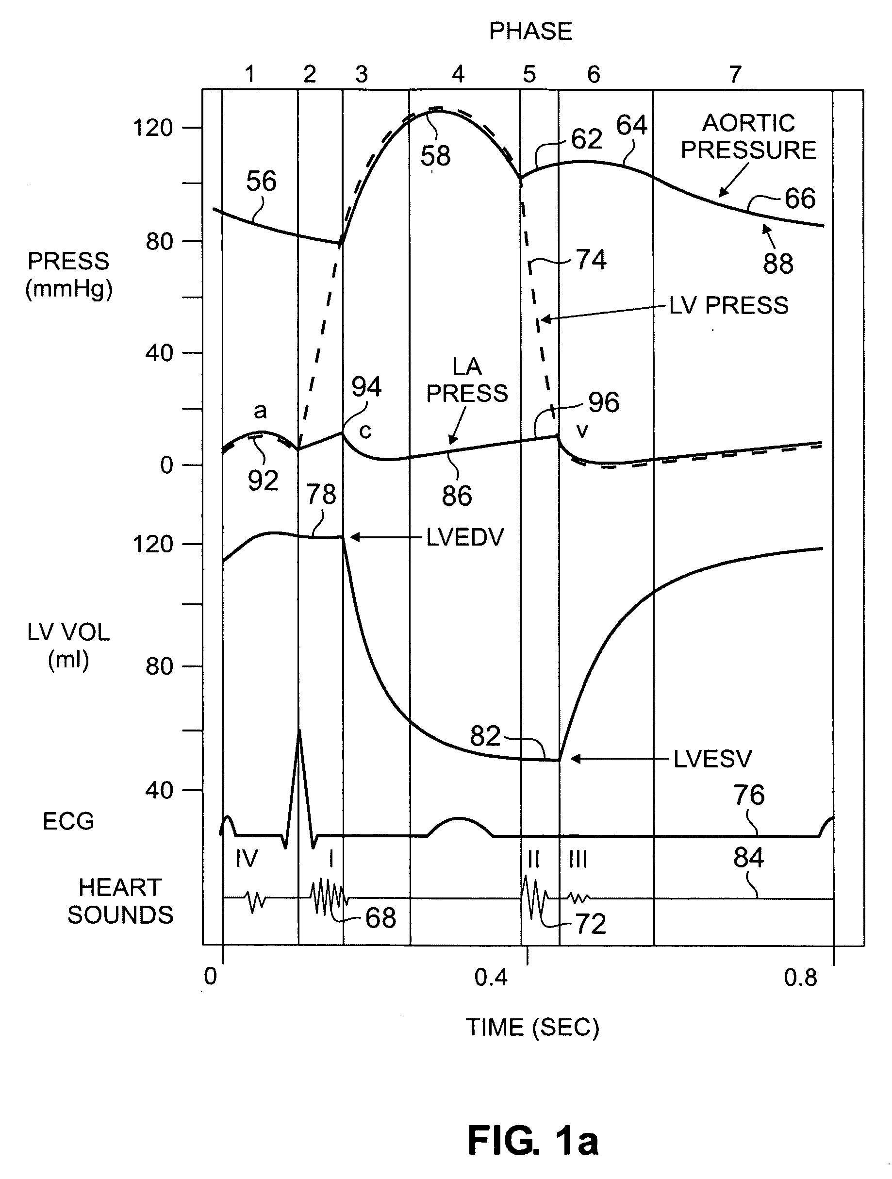 Devices and methods for accelerometer-based characterization of cardiac function and identification of LV target pacing zones