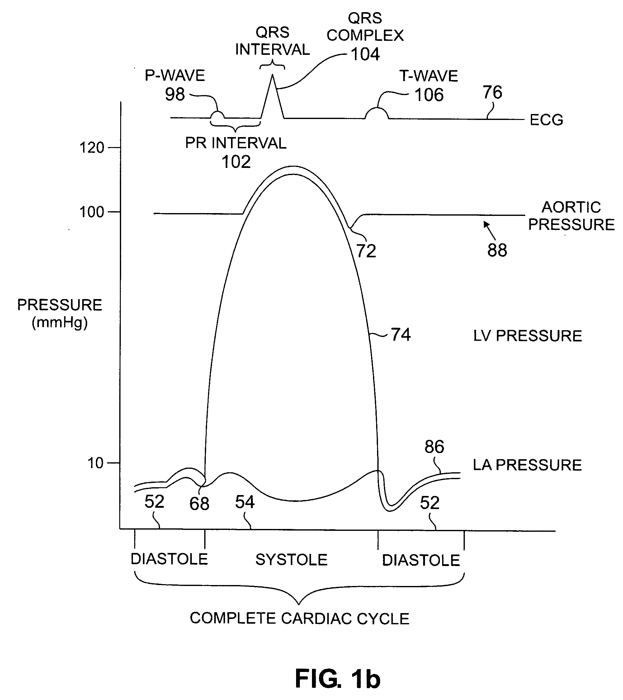 Devices and methods for accelerometer-based characterization of cardiac function and identification of LV target pacing zones