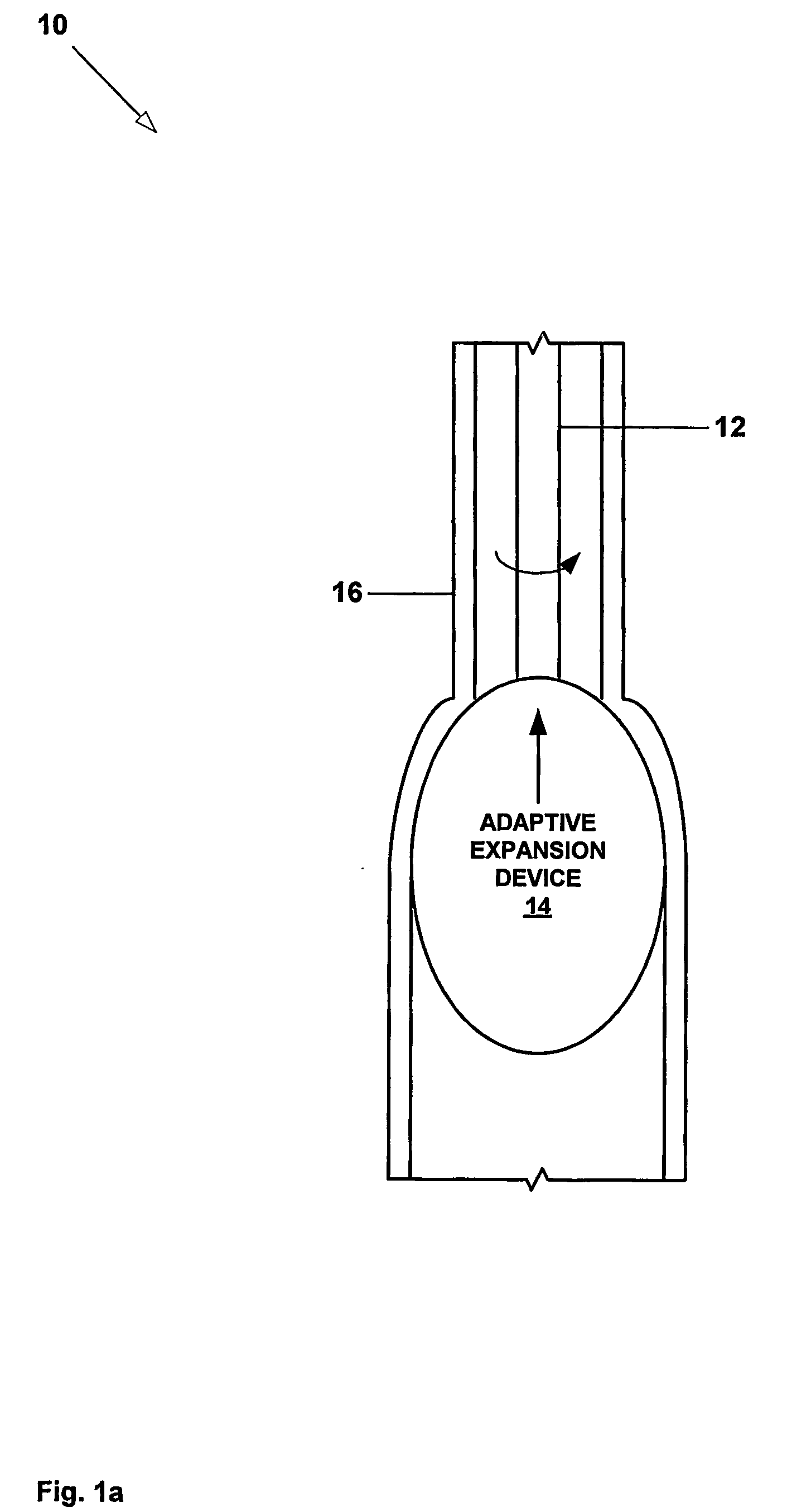 Apparatus and method for radially expanding a wellbore casing using and adaptive expansion system