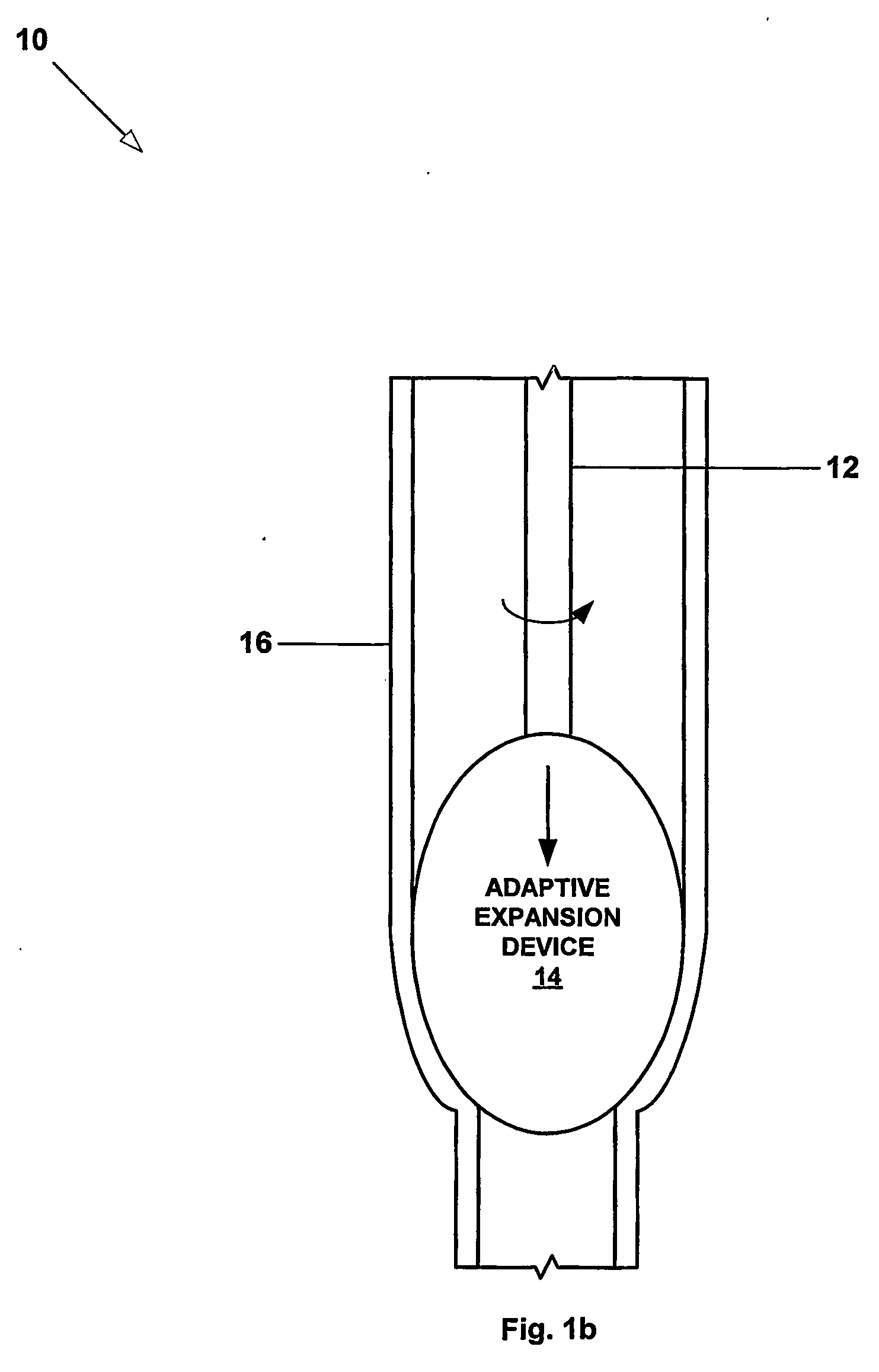 Apparatus and method for radially expanding a wellbore casing using and adaptive expansion system