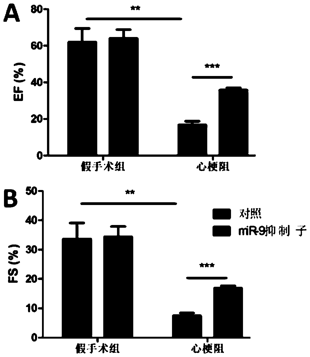 Application of miRNA inhibitor in the preparation of drugs for preventing and treating myocardial infarction