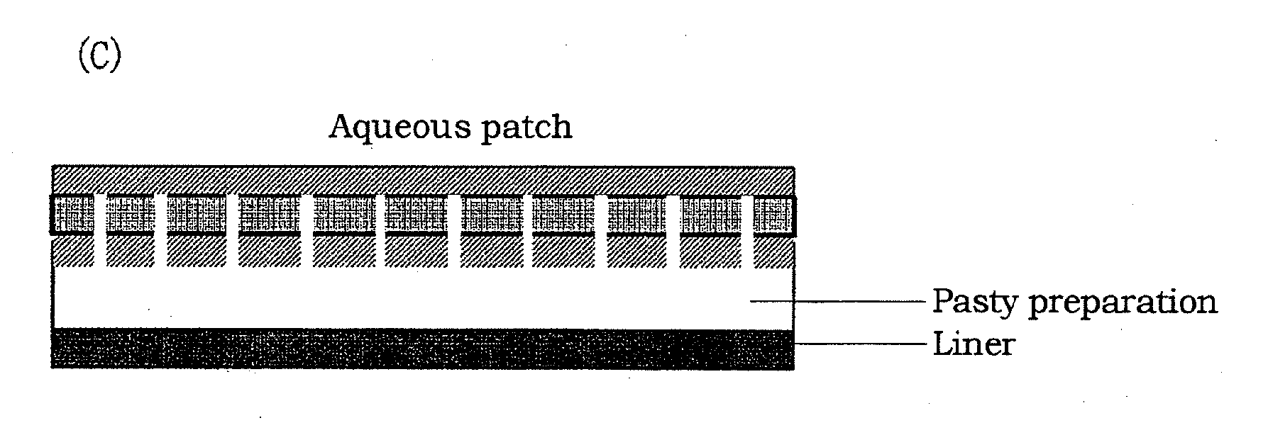 Backing having three-layer structure and aqueous patch using the backing