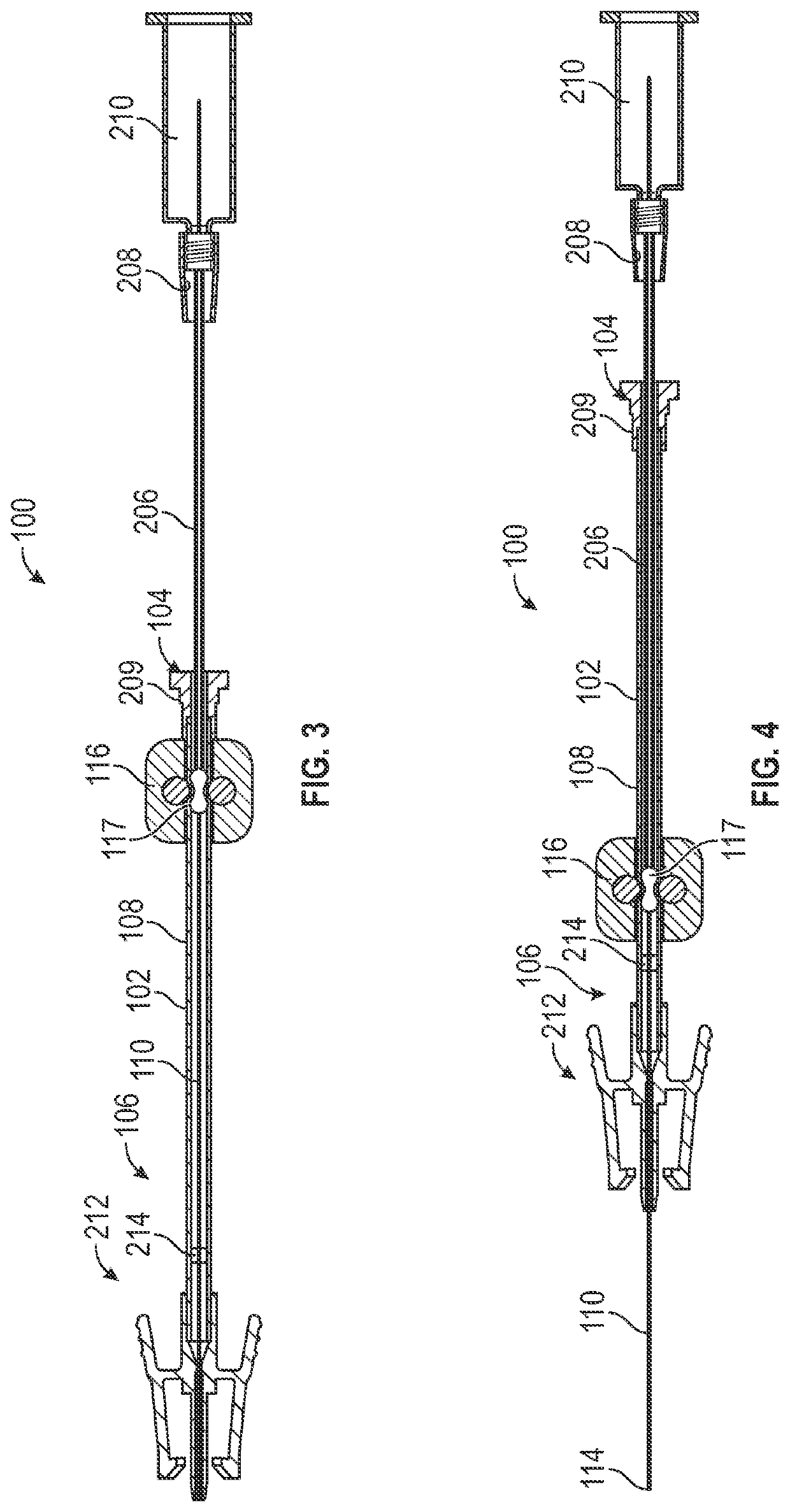 Extension set and related systems and methods