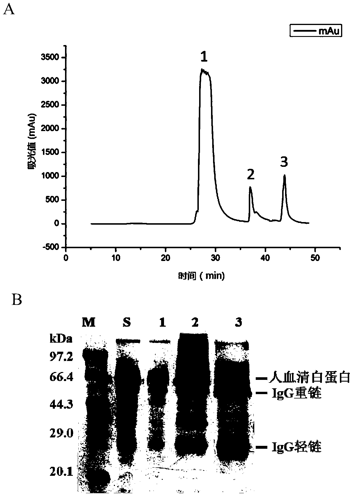 Fixed-point immobilization method for recombinant protein A affinity ligands