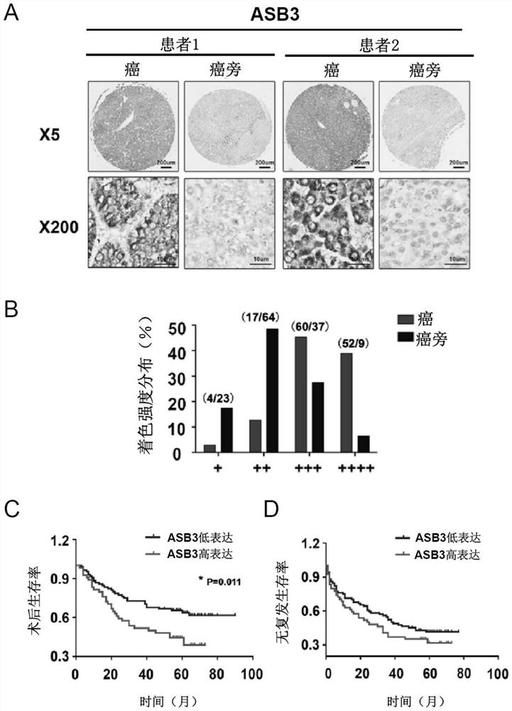 Application of e3 ubiquitin ligase asb3 in the preparation of therapeutic drugs for liver cancer