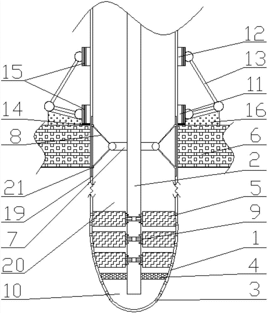 Anti-blockage unblocking apparatus with abdominal cavity drainage tubes