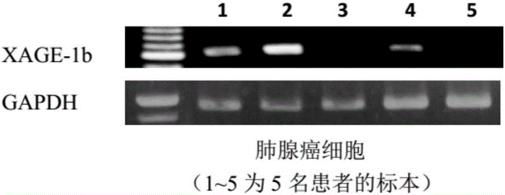 Tumor-associated antigen XAGE-1b short peptide and application thereof