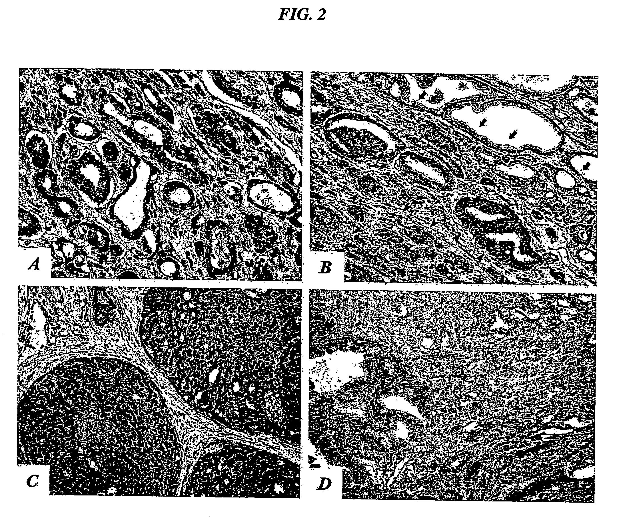 Compositions and methods of use of targeting peptides for diagnosis and therapy of human cancer
