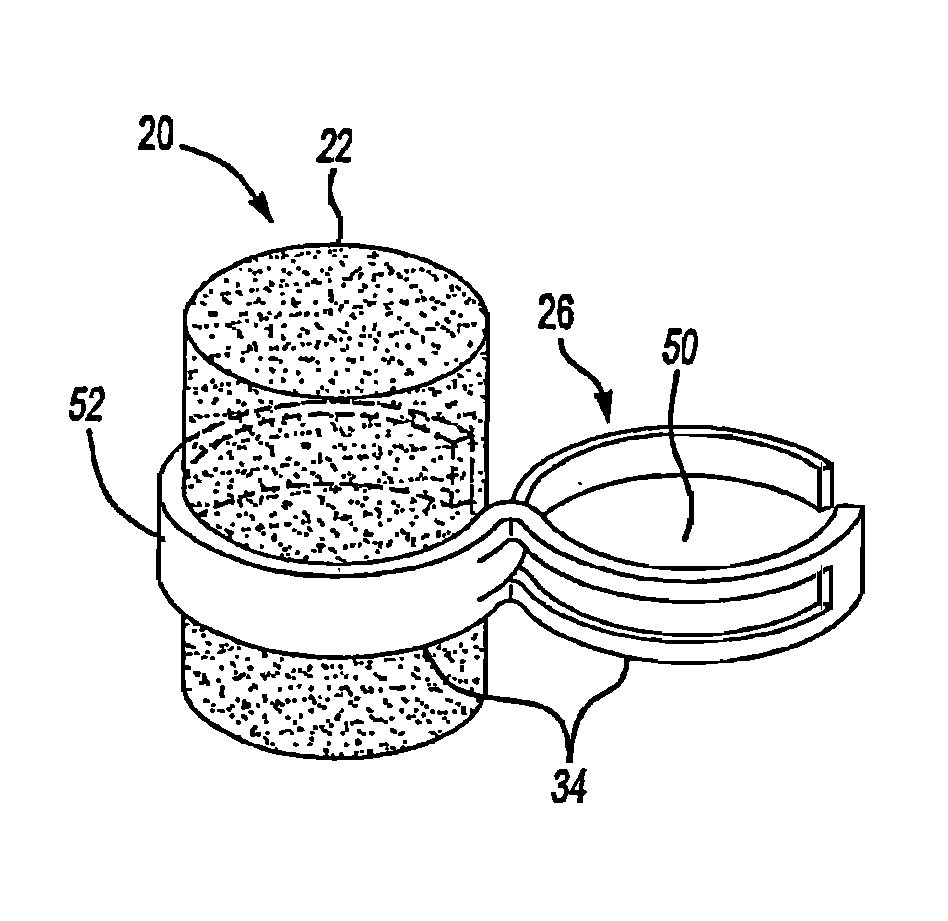 Improved middle ear implant and method