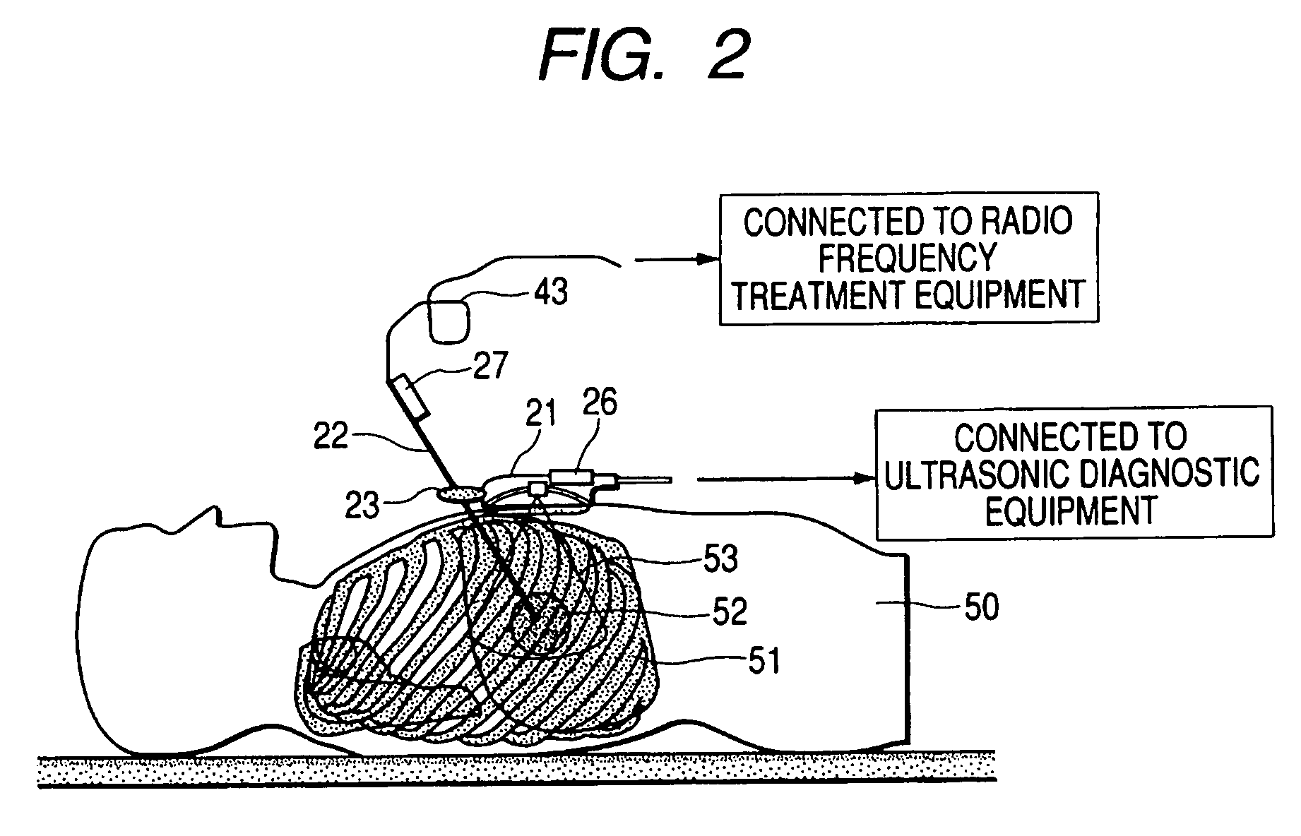 Ultrasonic diagnostic apparatus for fixedly displaying a puncture probe during 2D imaging