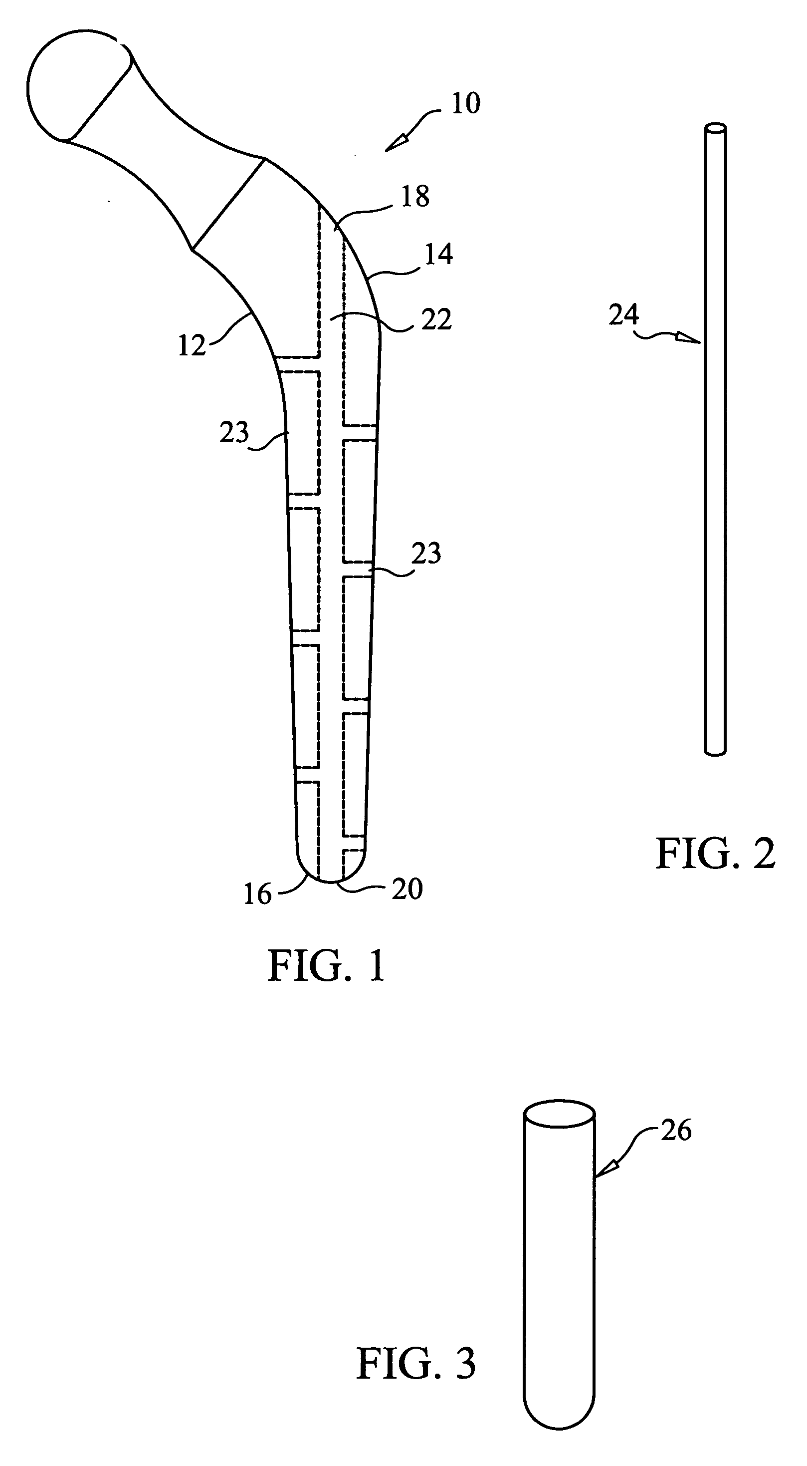 Orthopedic system for total hip replacement surgery