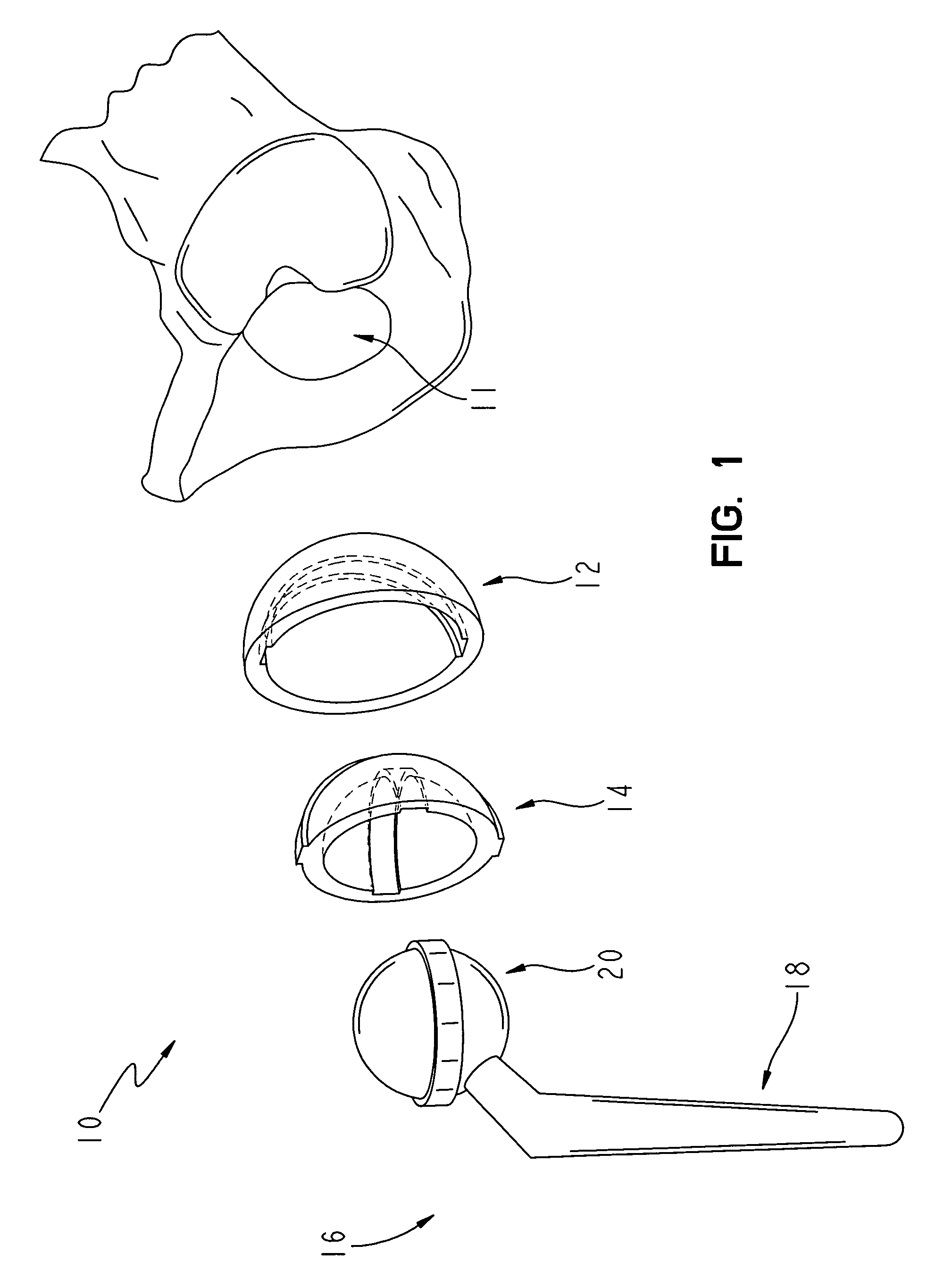 Reduced wear orthopaedic implant apparatus and method