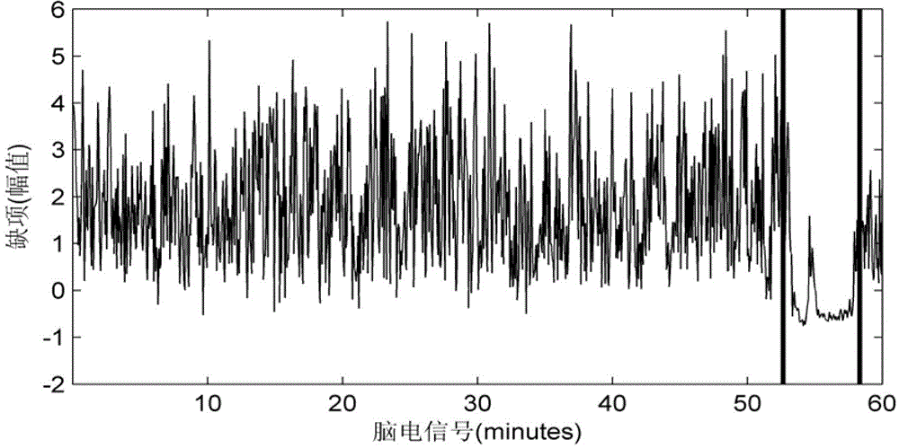 Electroencephalogram classification detection device based on lacuna characteristics