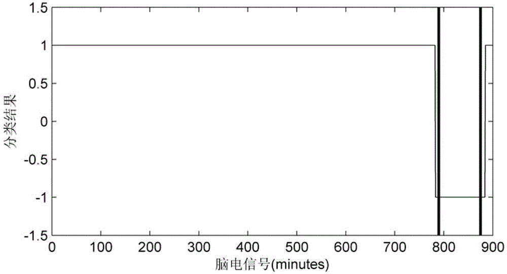 Electroencephalogram classification detection device based on lacuna characteristics