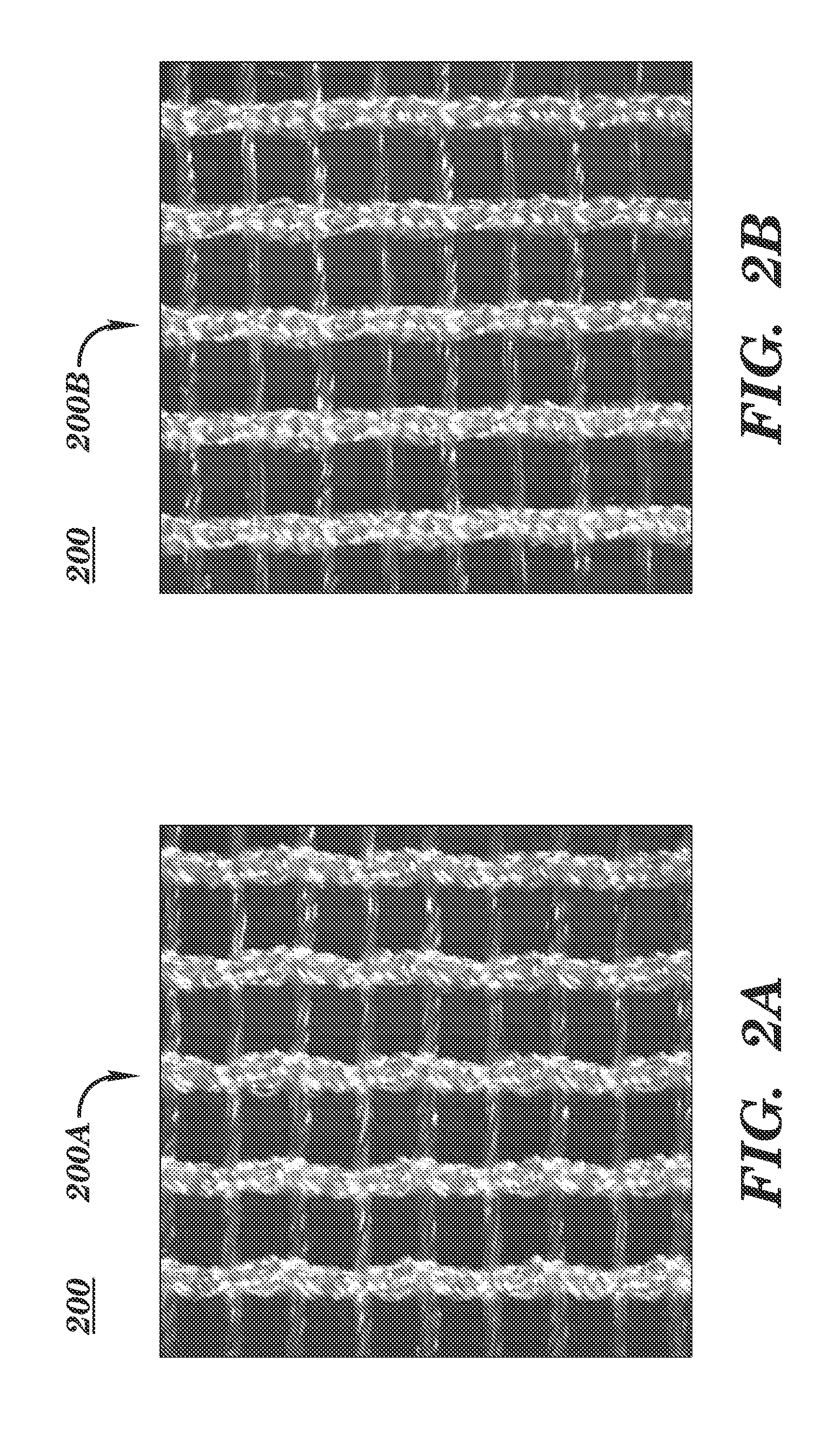 Prosthetic device having regions of varying stretch and method of manufacturing the same