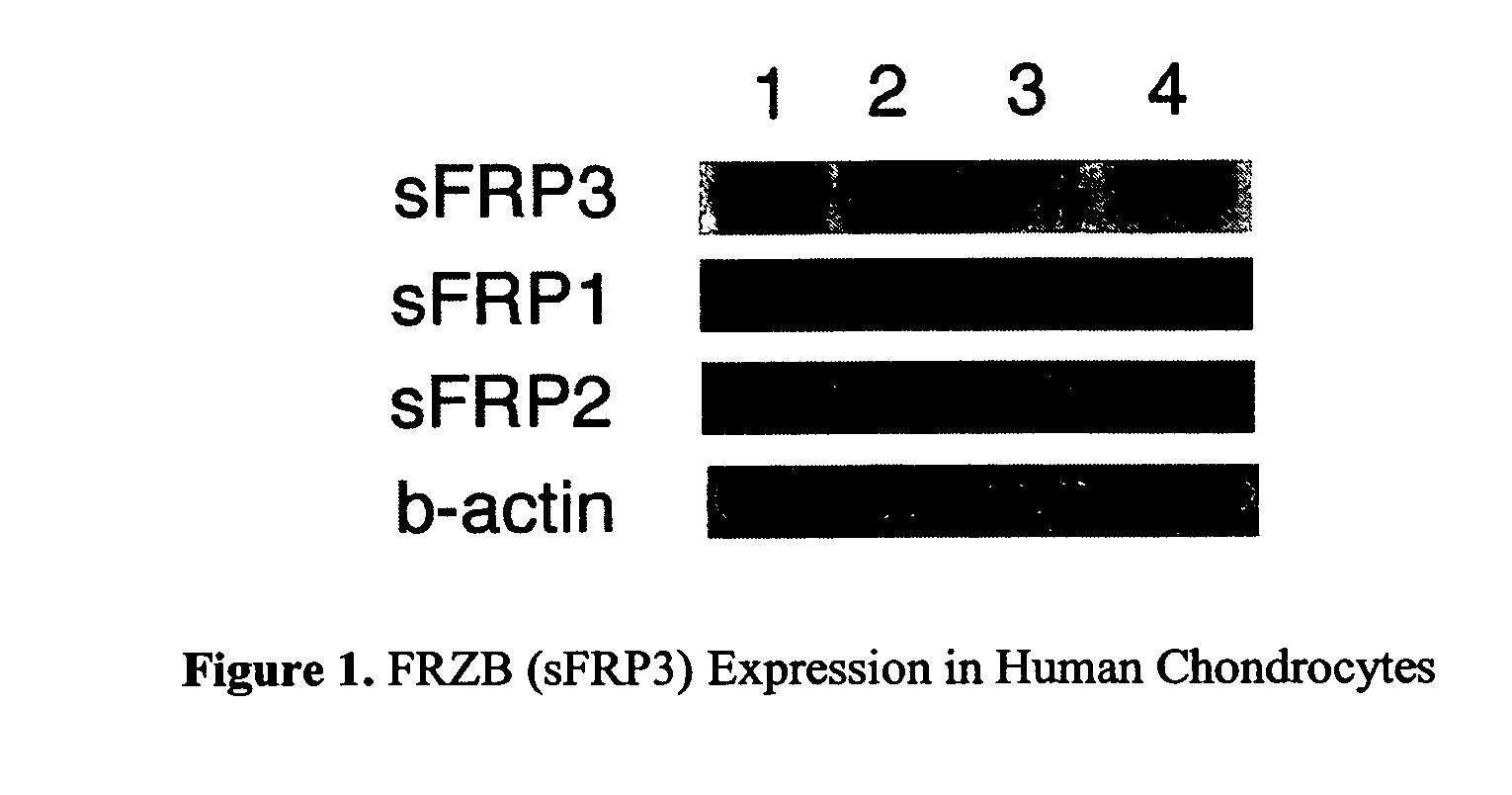 Mutations in WNT-frizzled signaling pathways associated with osteoarthritis