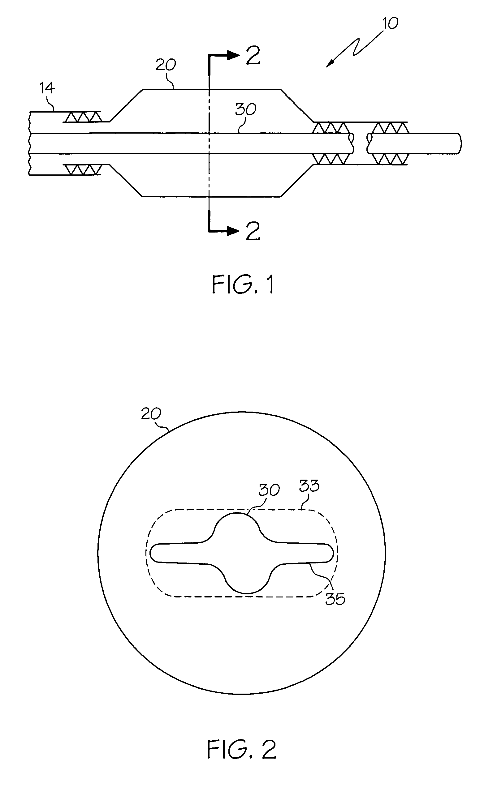 Balloon catheter with expandable wire lumen