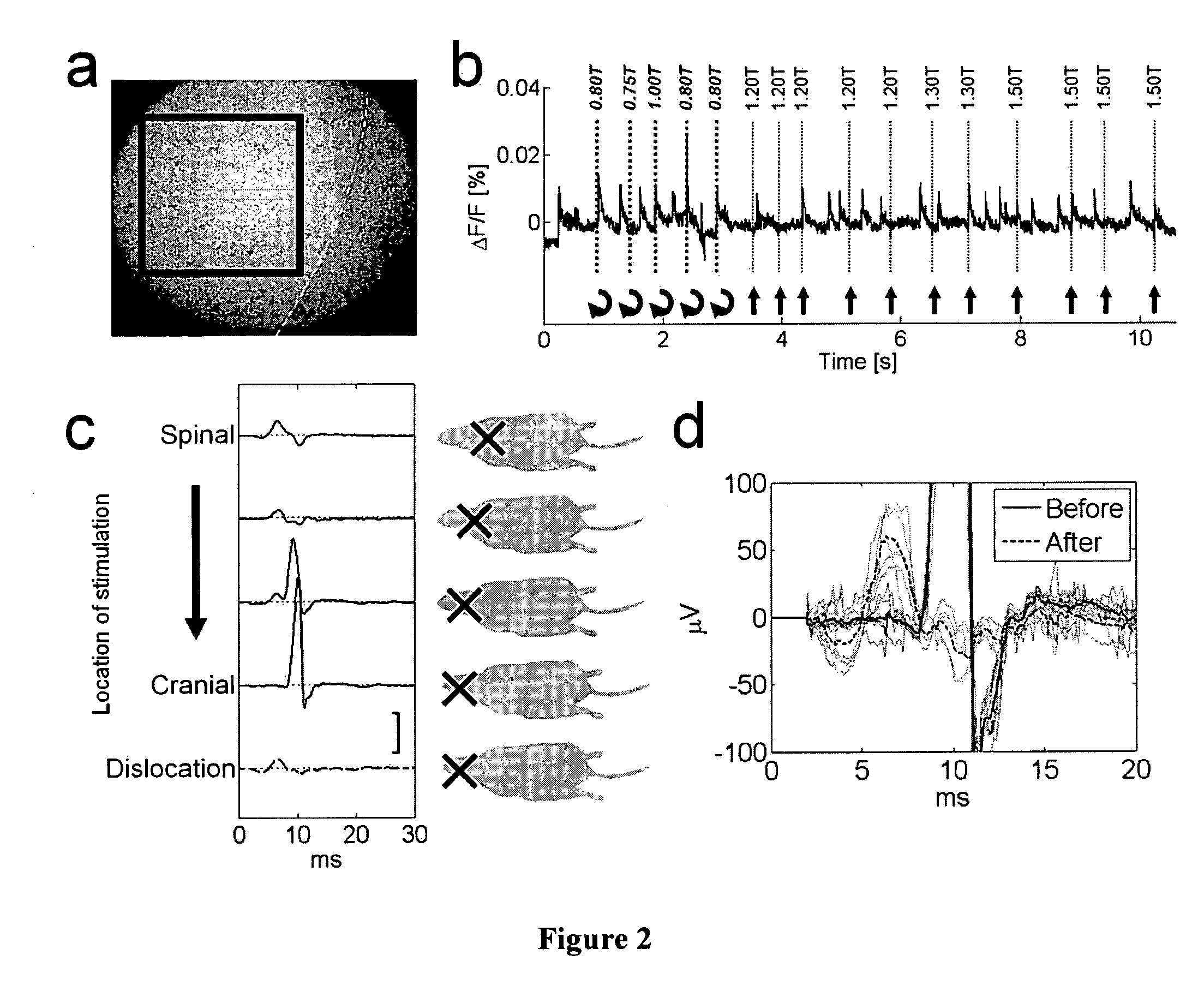 Magnetic configuration and timing scheme for transcranial magnetic stimulation