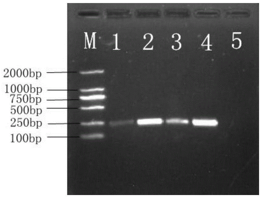 Recombinant bacteriocin and preparation method and application thereof