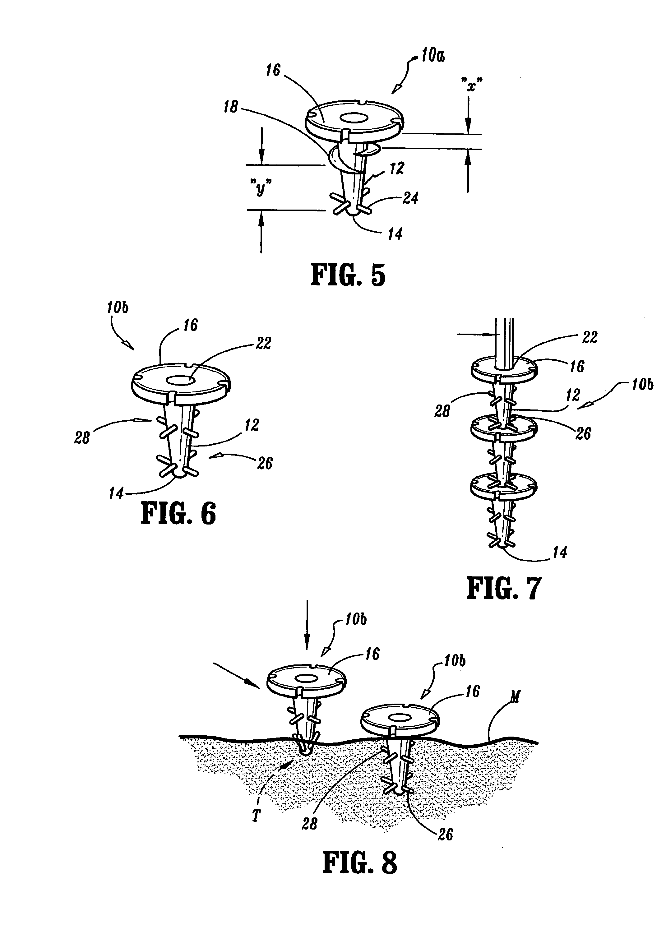 Surgical fasteners