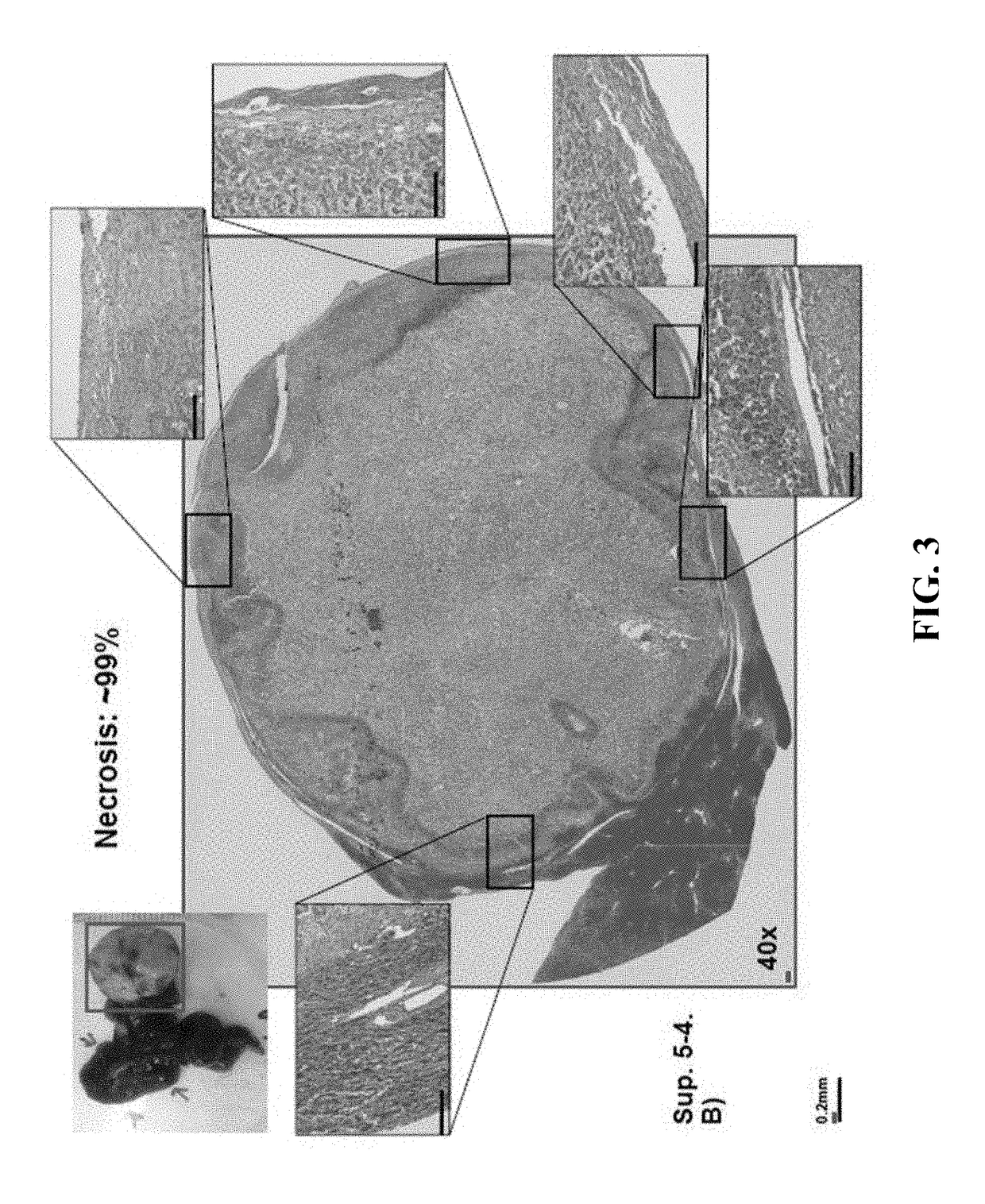 Compositions and methods for immune-mediated cancer therapy