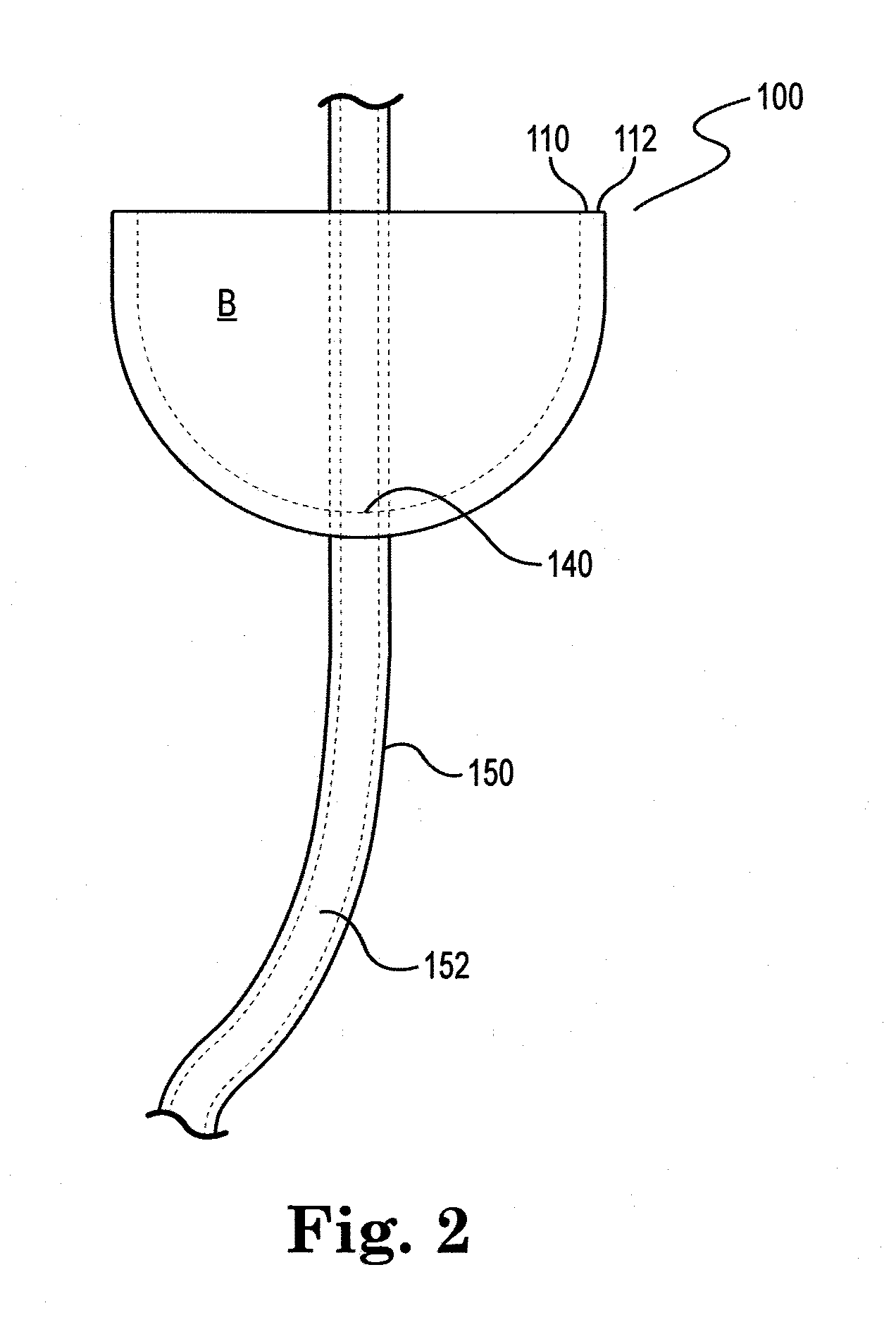 Device and method for illumination of vaginal fornix with ureter location, isolation and protection during hysterectomy procedure