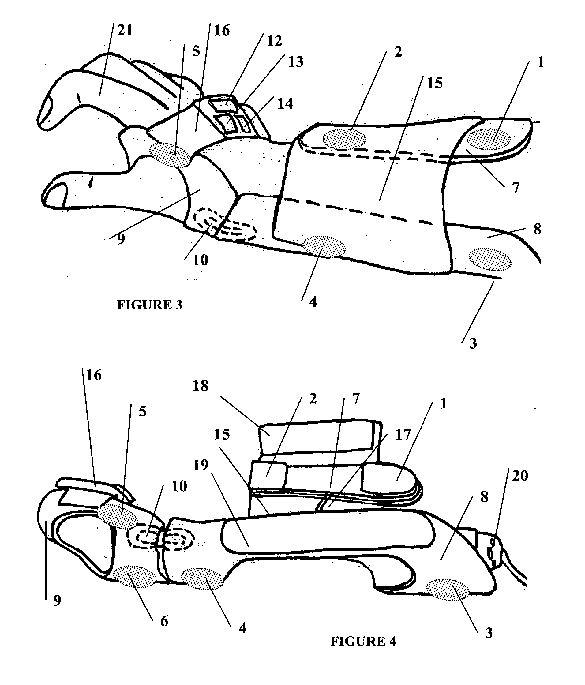 Functional electrical stimulation system