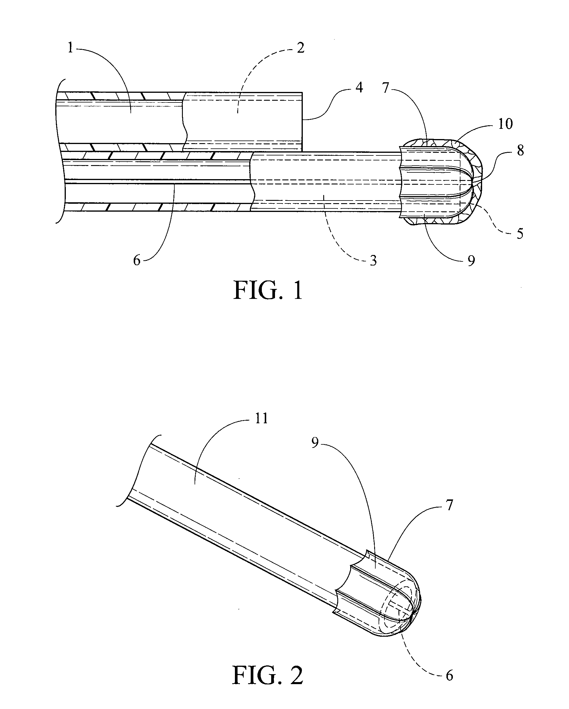 Hemodialysis catheter with thrombus blocker