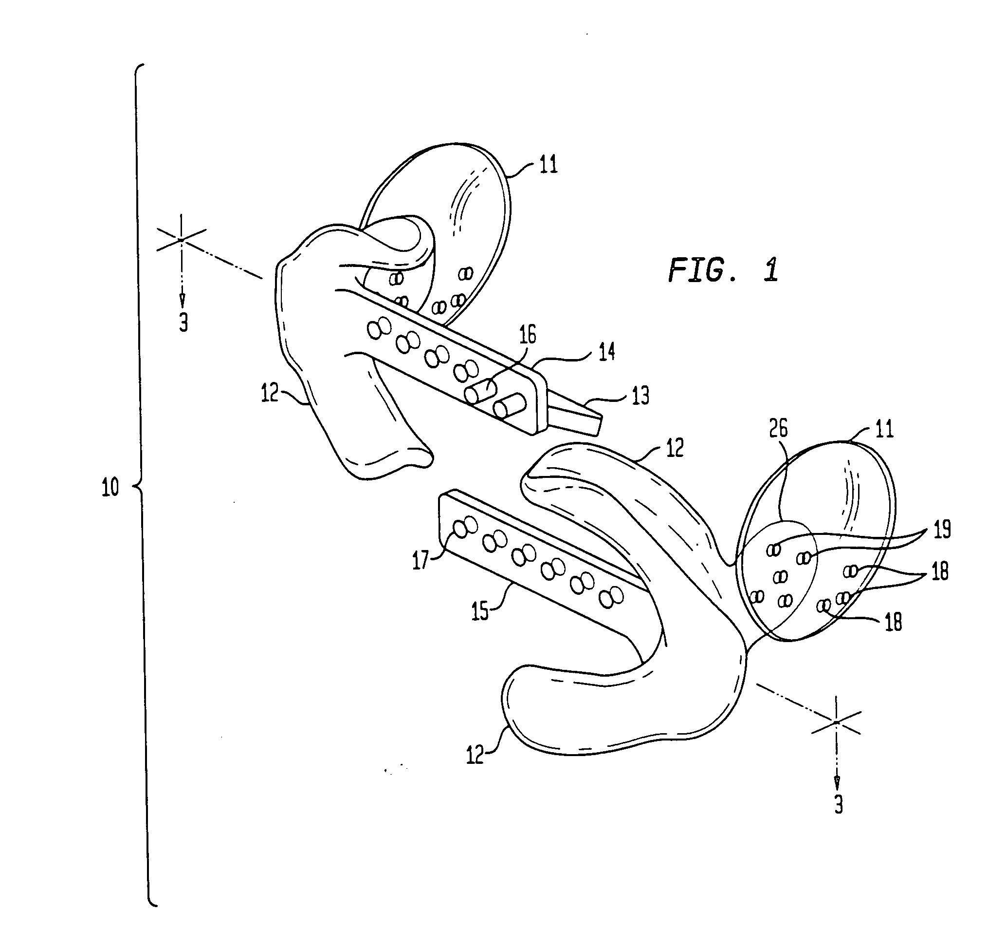 Dental retractor and method of use to produce anatomically accurate jaw models and dental prostheses