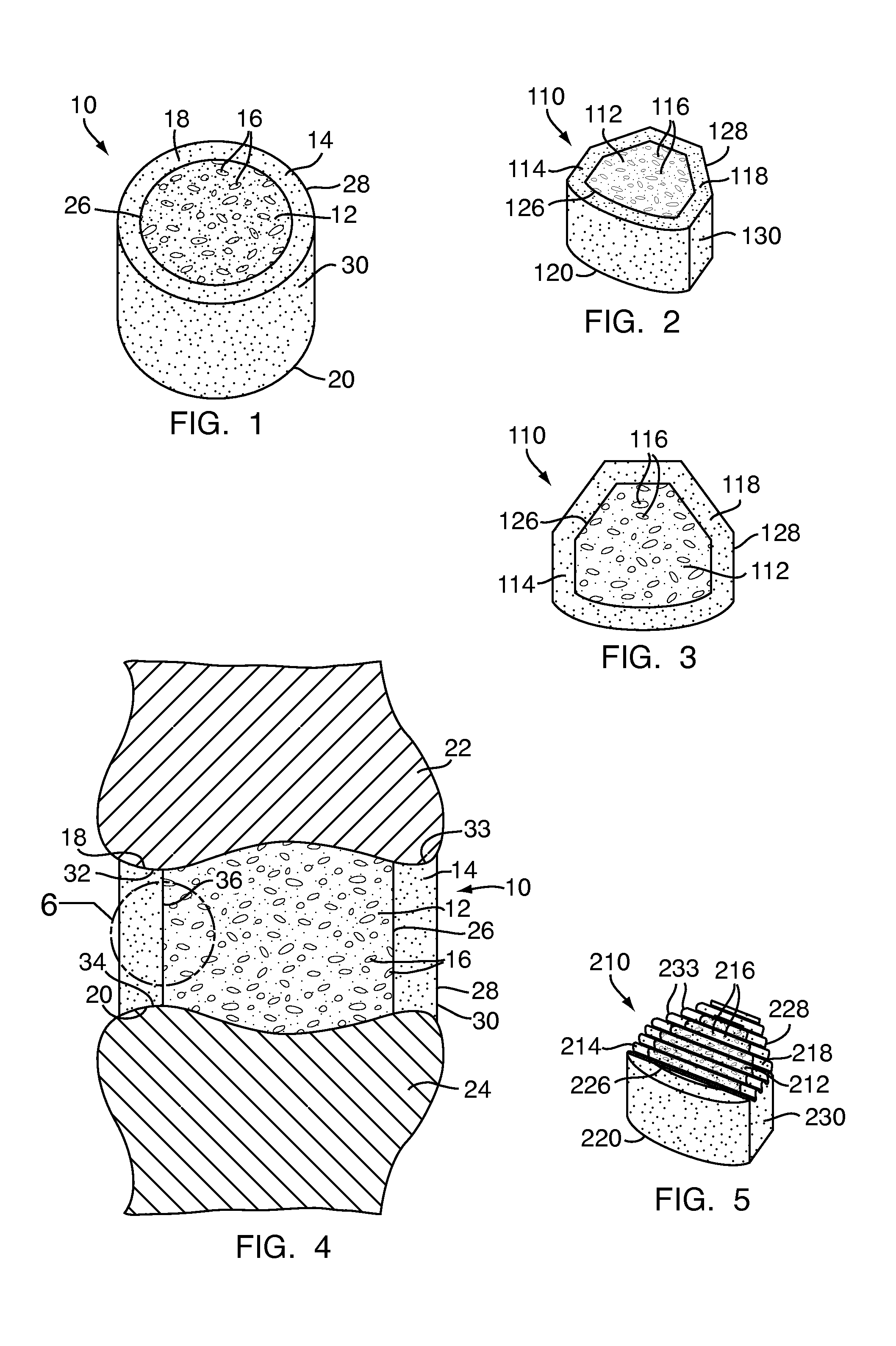 Multi-density polymeric interbody spacer