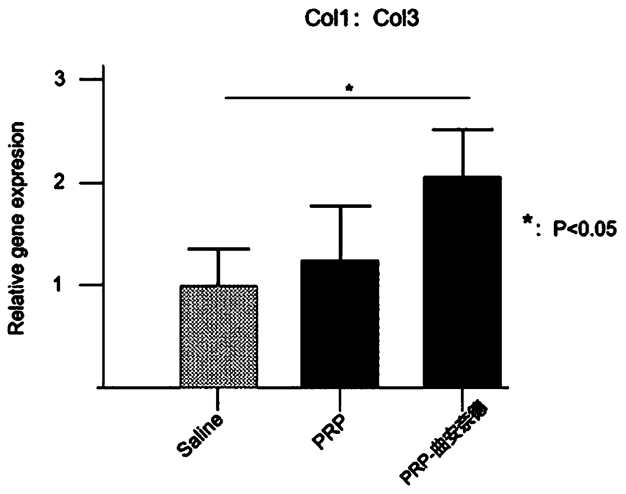 Platelet-rich plasma and triamcinolone acetonide combined compound for strain diseases and preparation method thereof