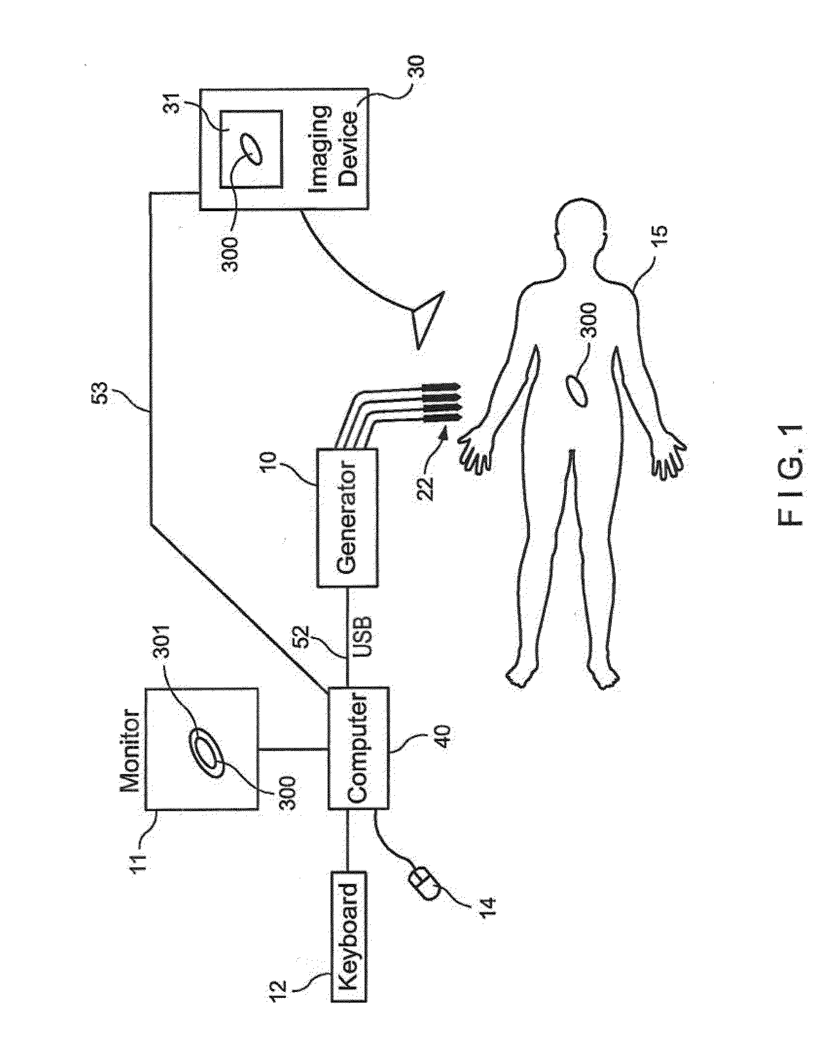 Methods of Sterilization and Treating Infection Using Irreversible Electroporation