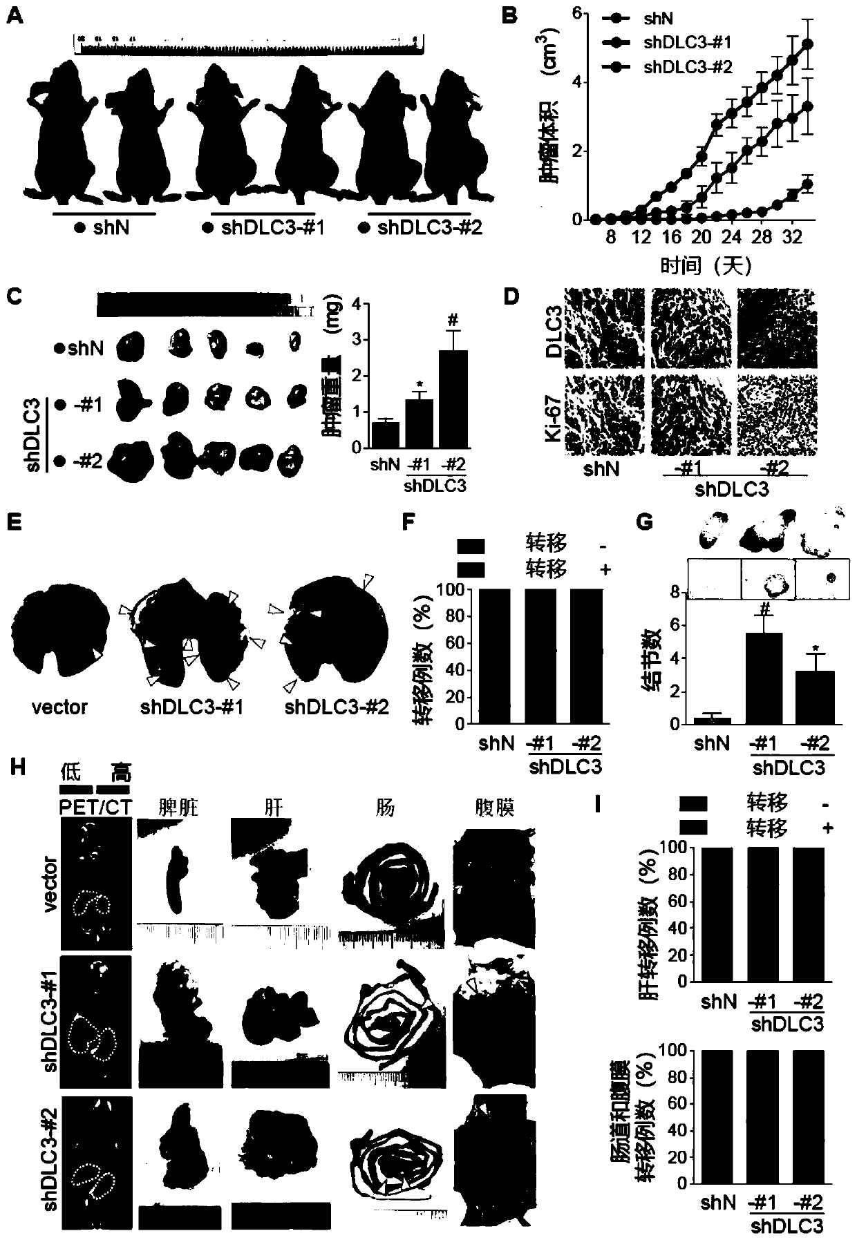 Use of DLC3 for preparation of drug for targeted treatment of gastric cancer