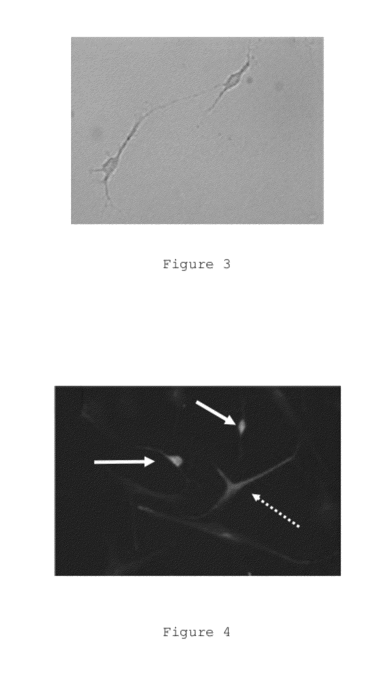 Differentiation process of mesenchymal stem cells and therapeutic use thereof