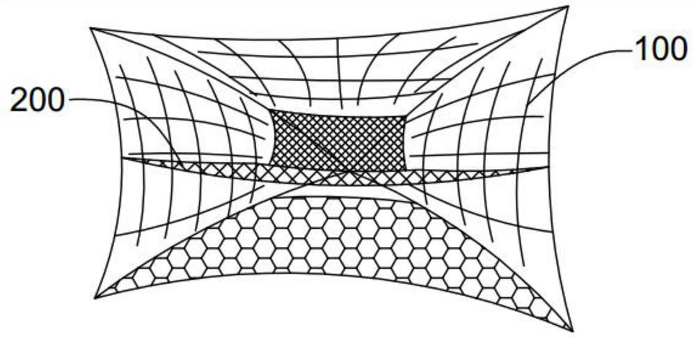 Layered net bag type trawl