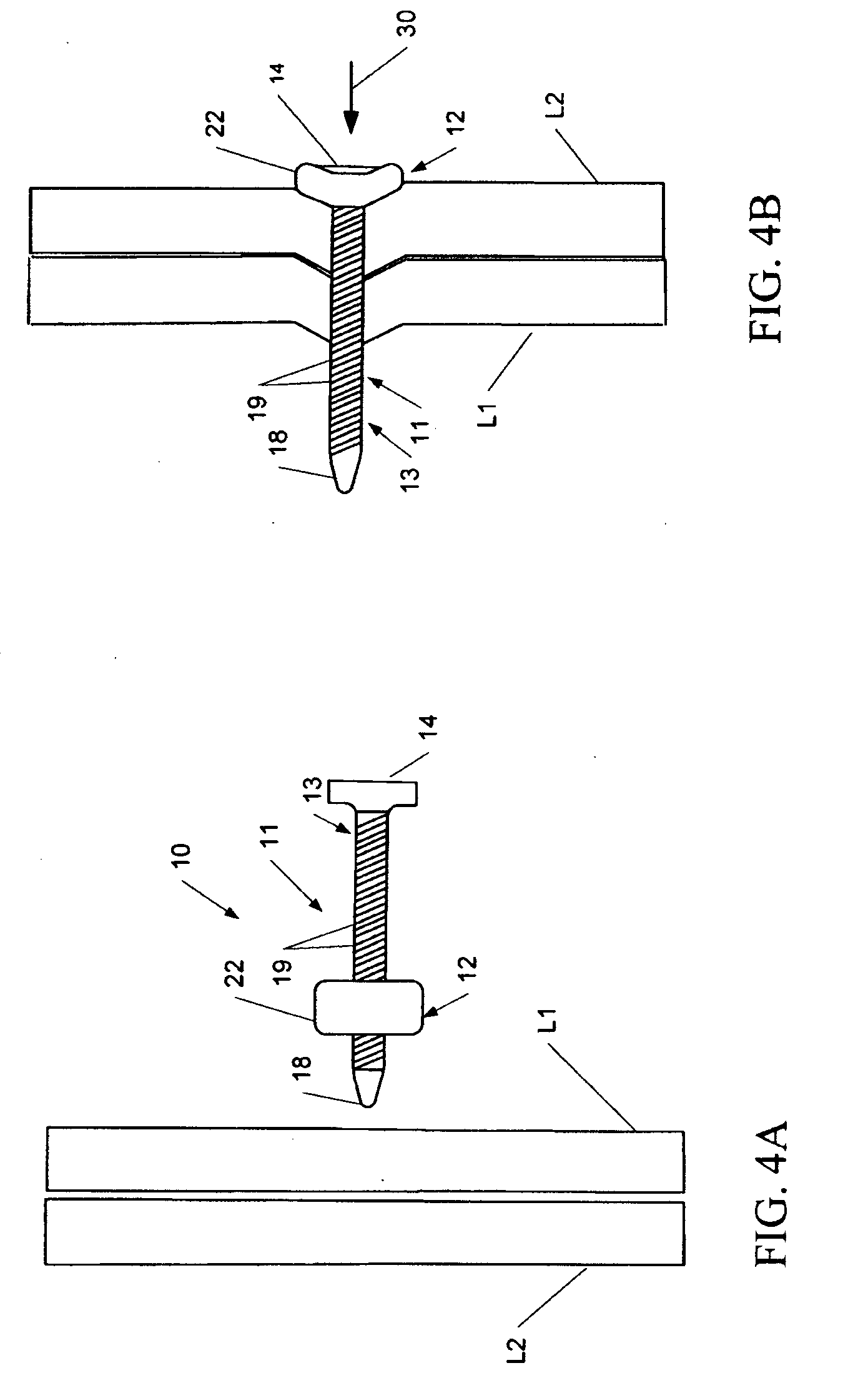 Fastening system