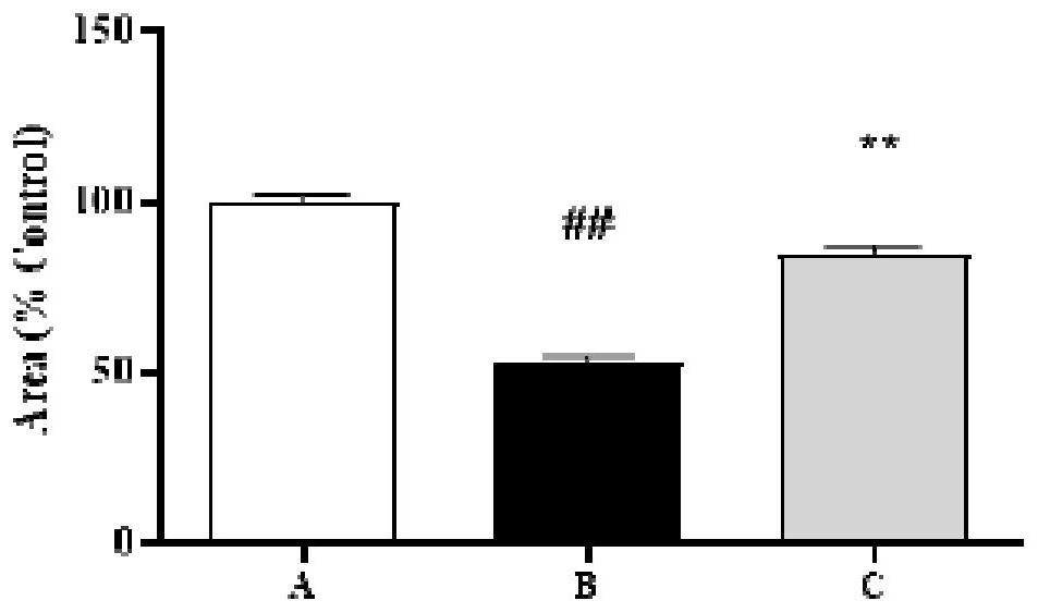 Pharmaceutical composition and application thereof in preparation of anti-osteoporosis drugs