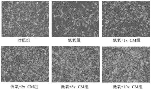Dental pulp stem cell conditioned medium and preparation method and application thereof