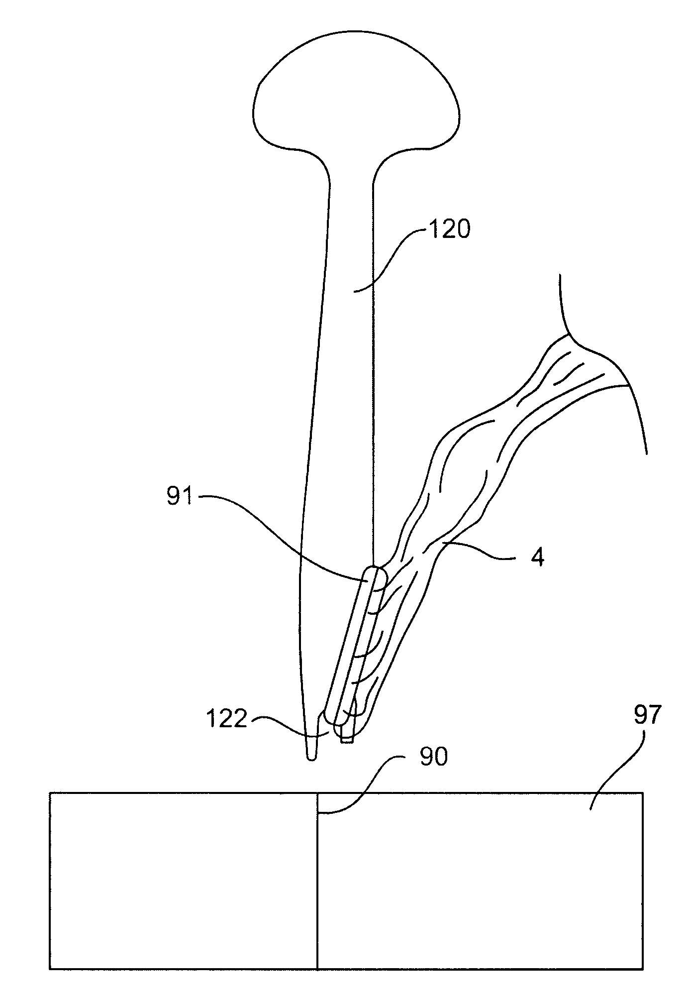 Wound retractor system