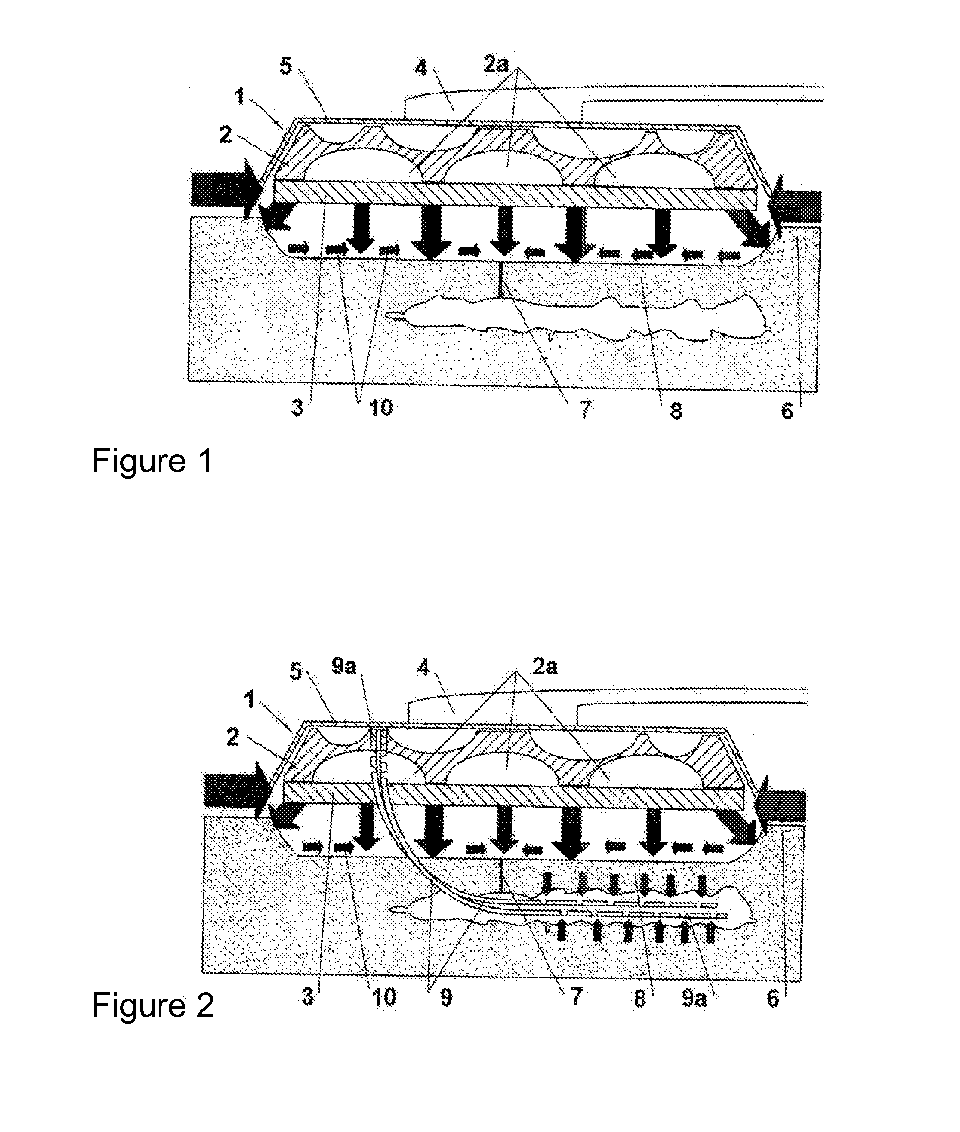 Perfecting of the improved vacuum dressing and the use thereof in vacuum-assisted therapy