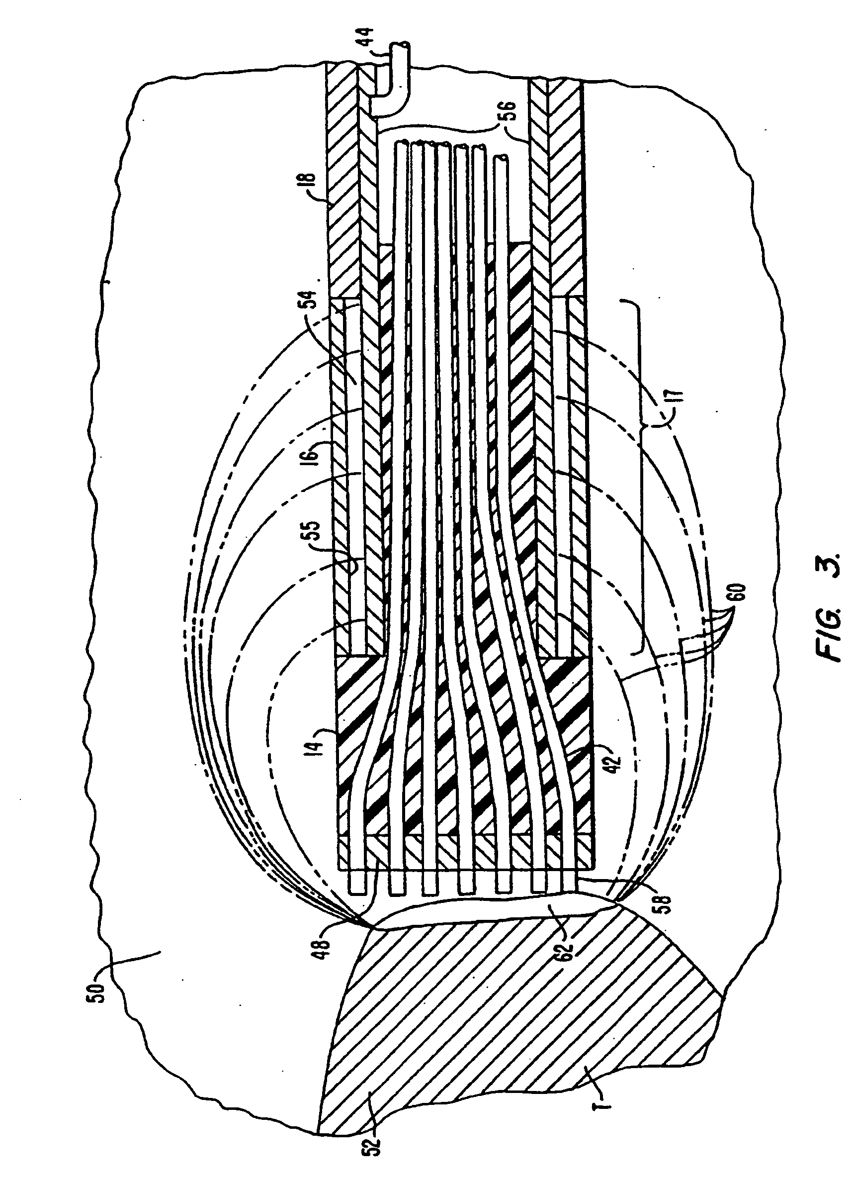 Methods for electrosurgical tissue treatment between spaced apart electrodes