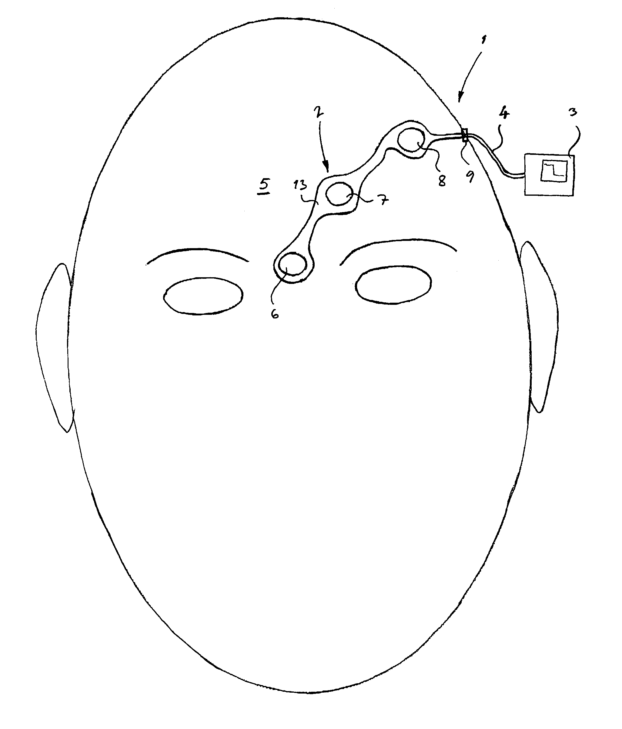 Method of positioning electrodes for central nervous system monitoring and sensing pain reactions of a patient